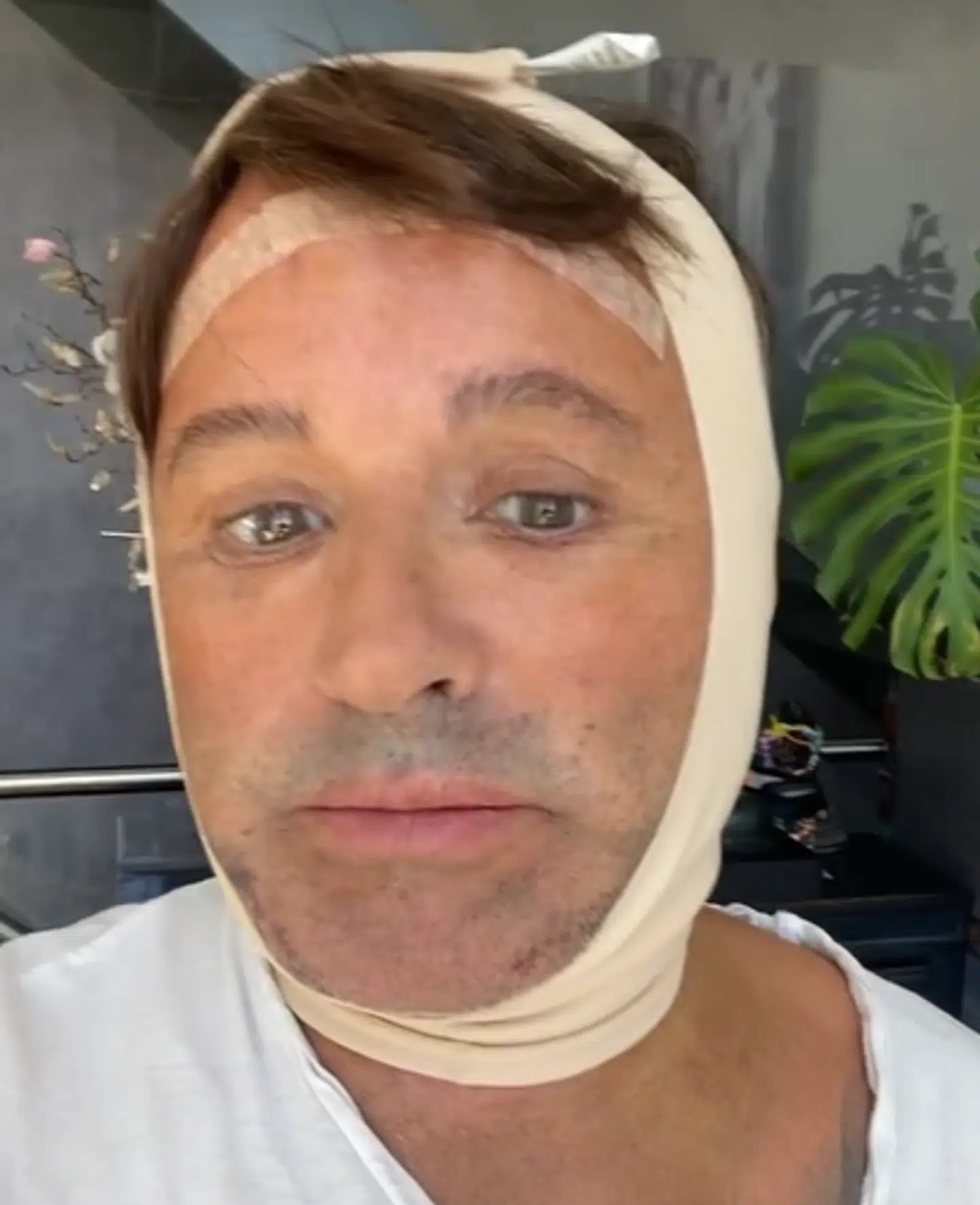 Dennis Knudsen undergik en ligeledes omfattende helingsproces efter sit store ansigtsløft. Foto: Privat.