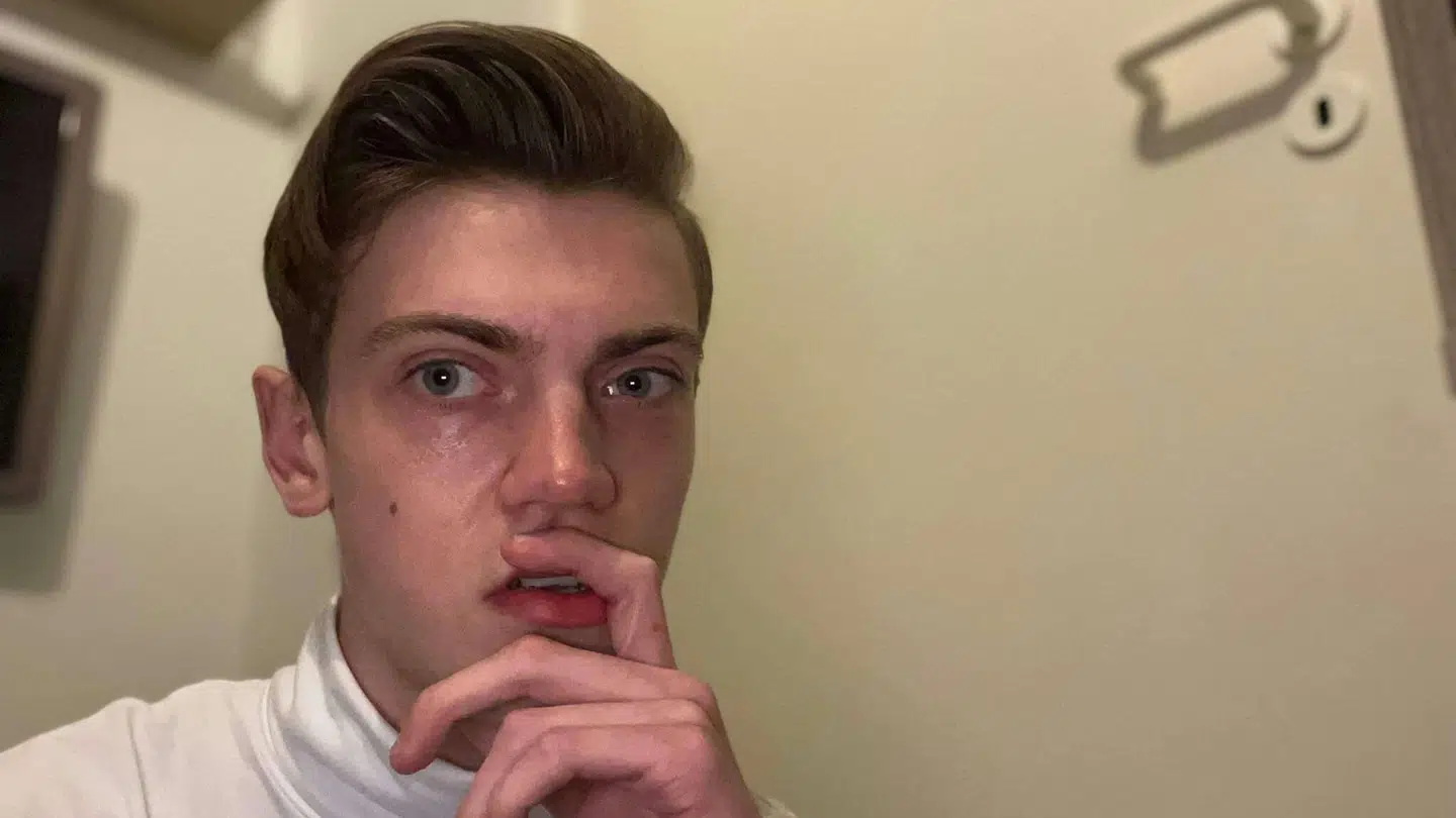 Nichlas Gemmer og resten af familiens kanin mistede livet på årets sidste dag.