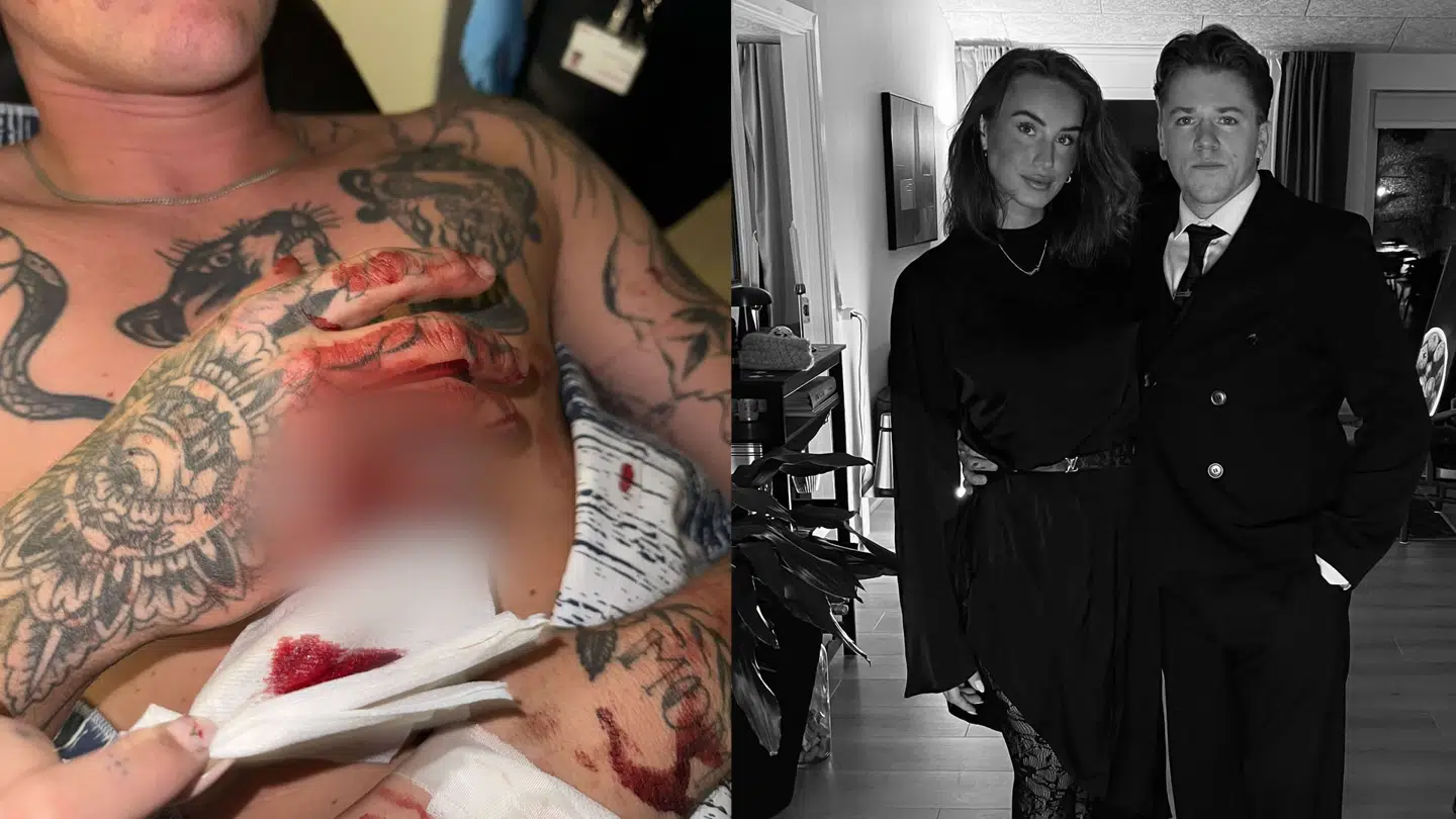 Til venstre ses Marcus på hospitalet. Til højre ses Feline og Marcus sammen.