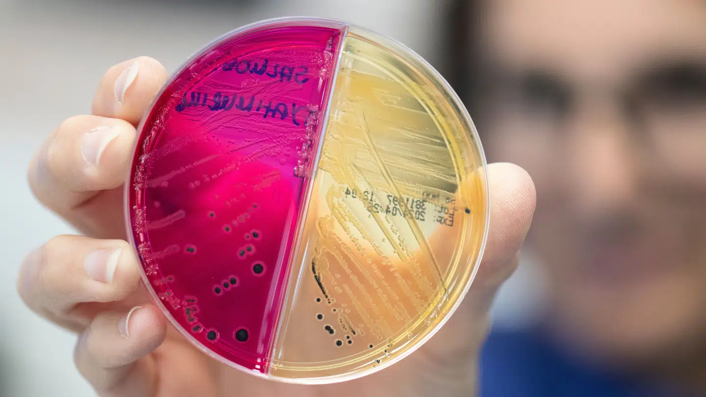Bakterieprøver og oplysninger fra patienternes betalingskort skal i nyt projekt hjælpe SSI til at finde kontaminerede fødevarer.
