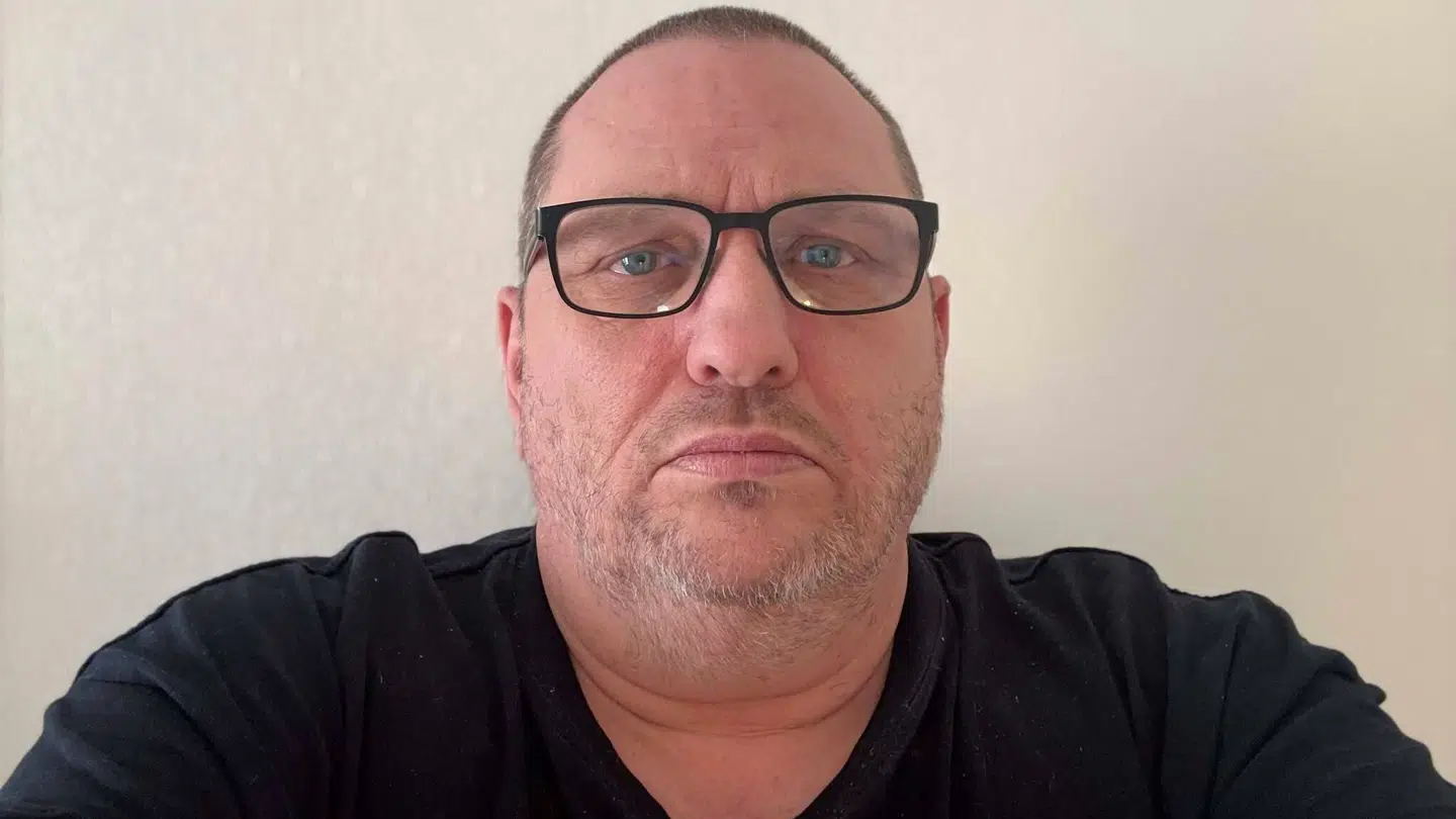 Claus Heine er en af ni personer, der har anmeldt til Patienterstatningen, at de har fået en øjensygdom som en mulig bivirkning ved at tage Wegovy eller Ozempic.