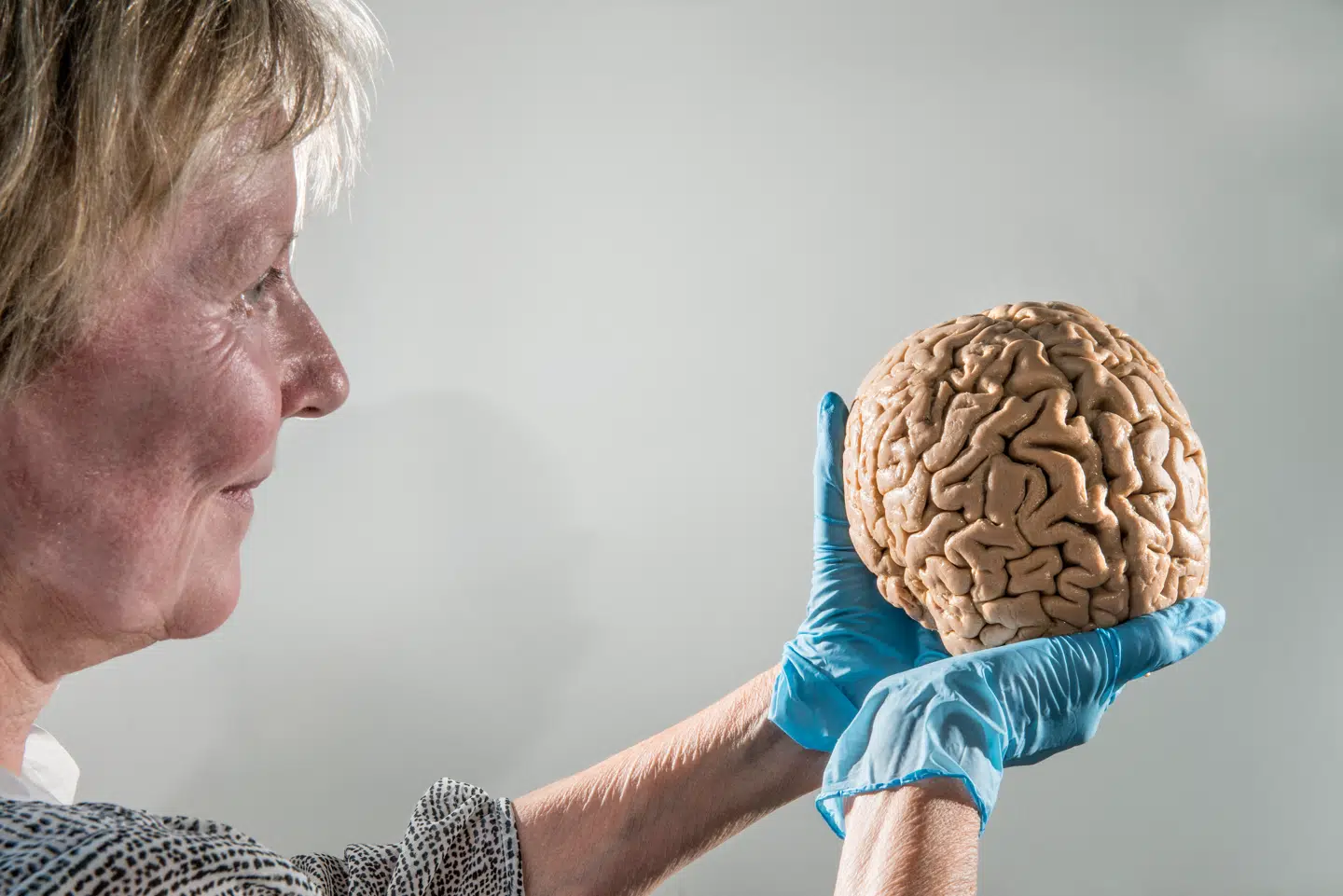 Indtil videre er hjernesygdommen Alzheimers sygdom uhelbredelig, og årsagen er – bortset fra en lille andel arvelige tilfælde – ukendt. Nu har forskere en ny teori om, hvordan sygdommen opstår.