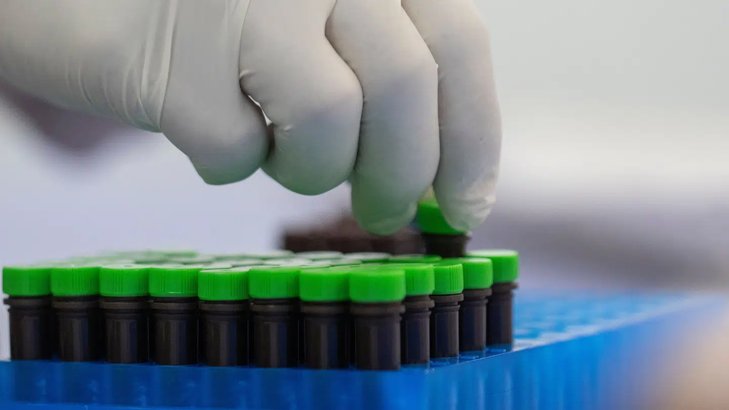 Arkivfoto af et mpox-testsæt.