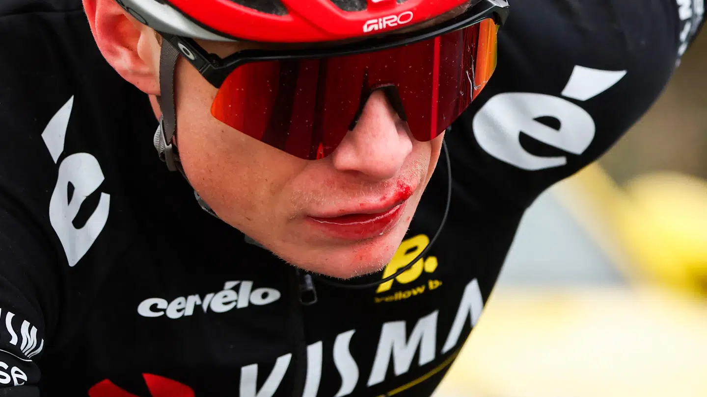 Jonas Vingegaard styrtede på femte etape af Paris-Nice og pådrog sig en hjernerystelse. Men det blev først meldt ud en del senere, her i B.T.s spalter.