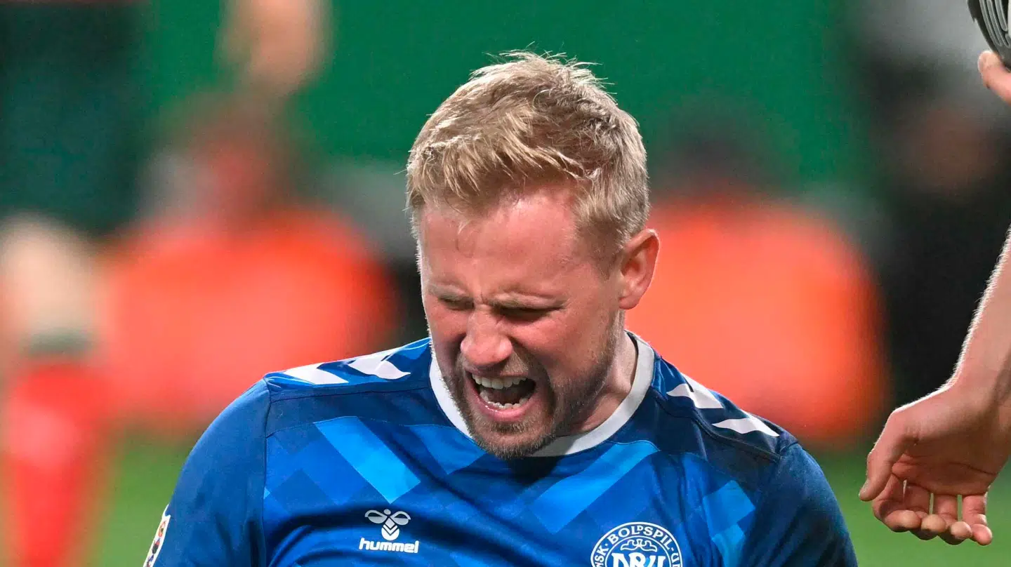 Schmeichel ville ikke forlade banen trods skaden.