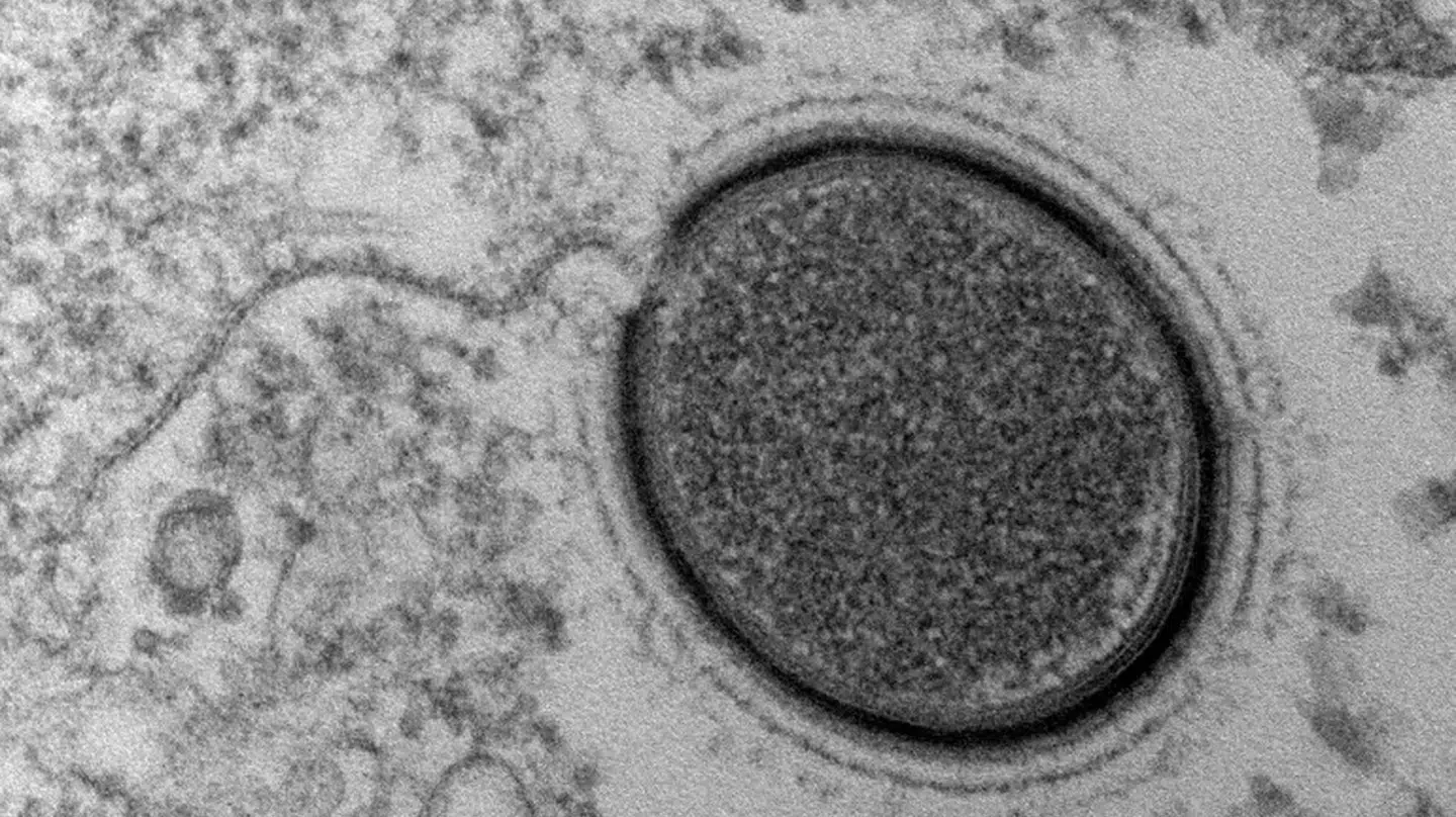 Arkivfoto: Dette mollivirus blev fundet efter at være nedfrosset i den sibiriske permafrost i over 30.000 år.