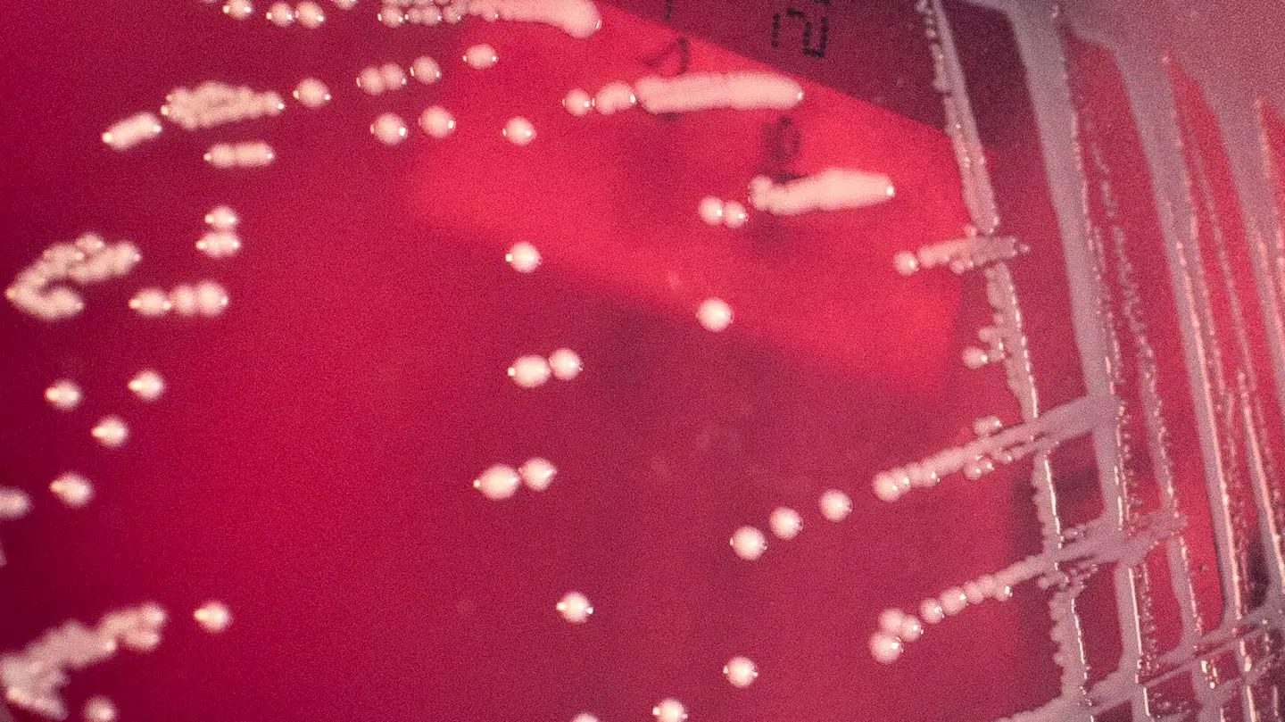 Billede af gruppe A streptokokker-bakterier, der blandt andet kan føre til nekrotiserende fasciitis.