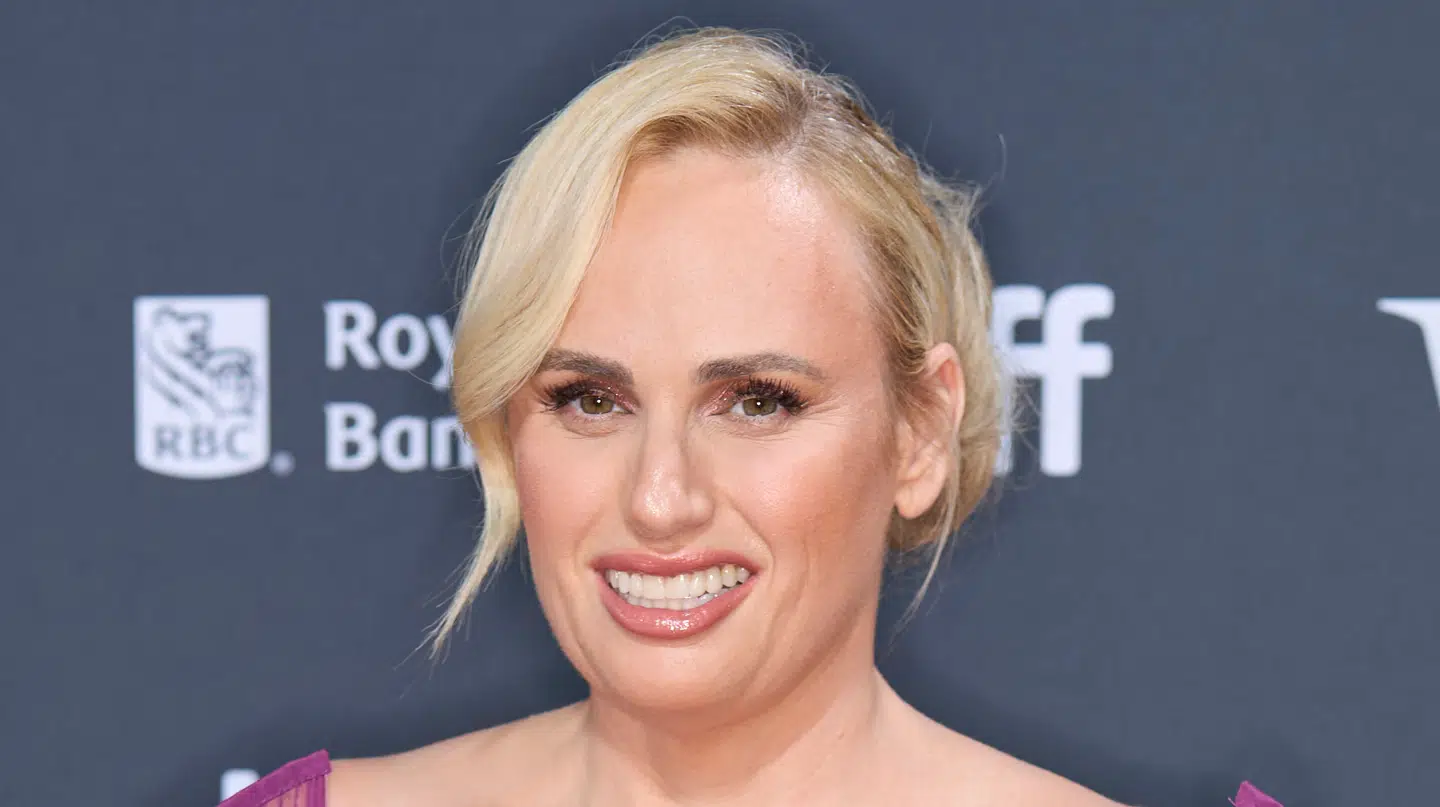 Rebel Wilson er en af dem, som, Dr. Green mener, døjer med 'Ozempic-mund'.