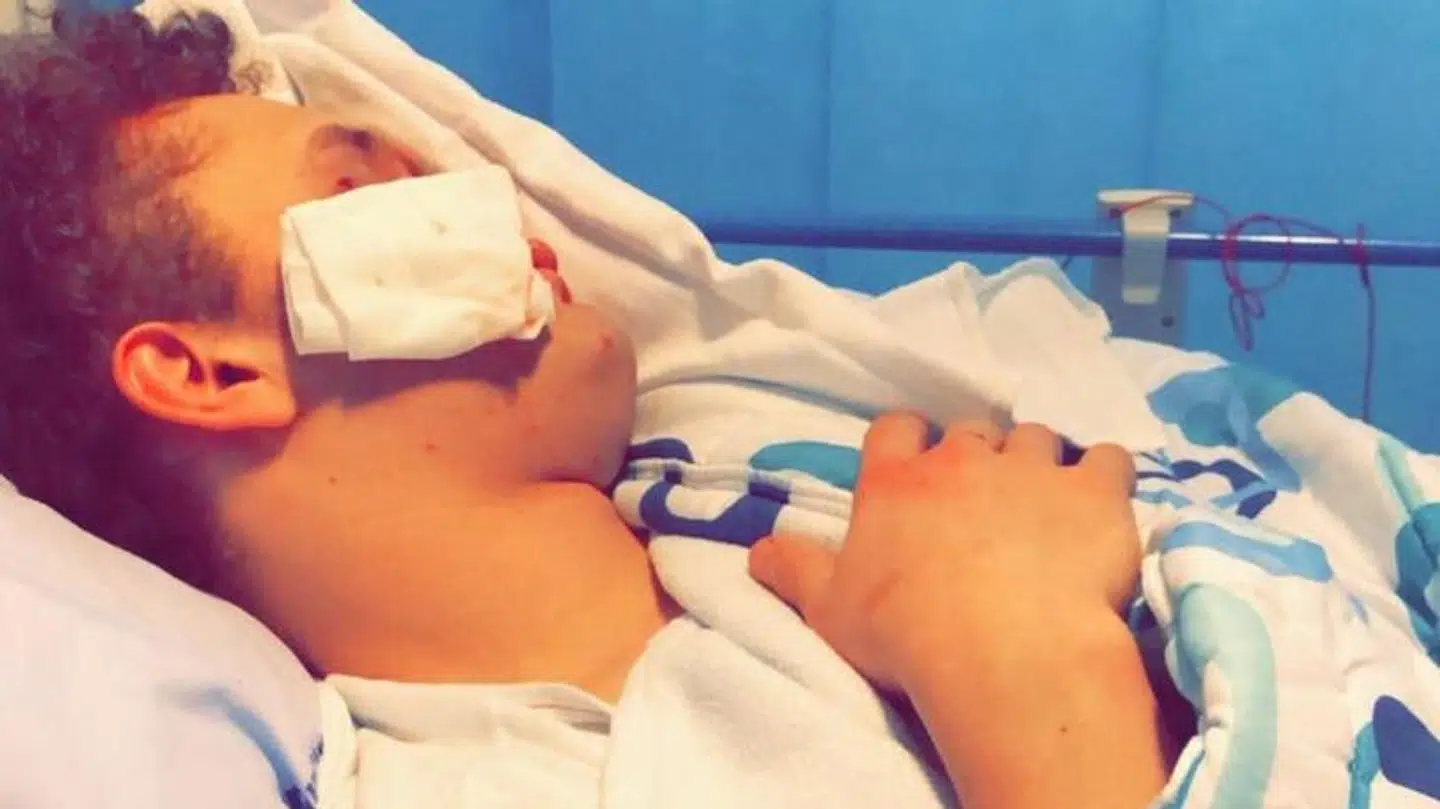 Da Lauritz Lindboe Wind vågnede morgenen efter på hospitalet, huskede han ikke meget fra overfaldet.