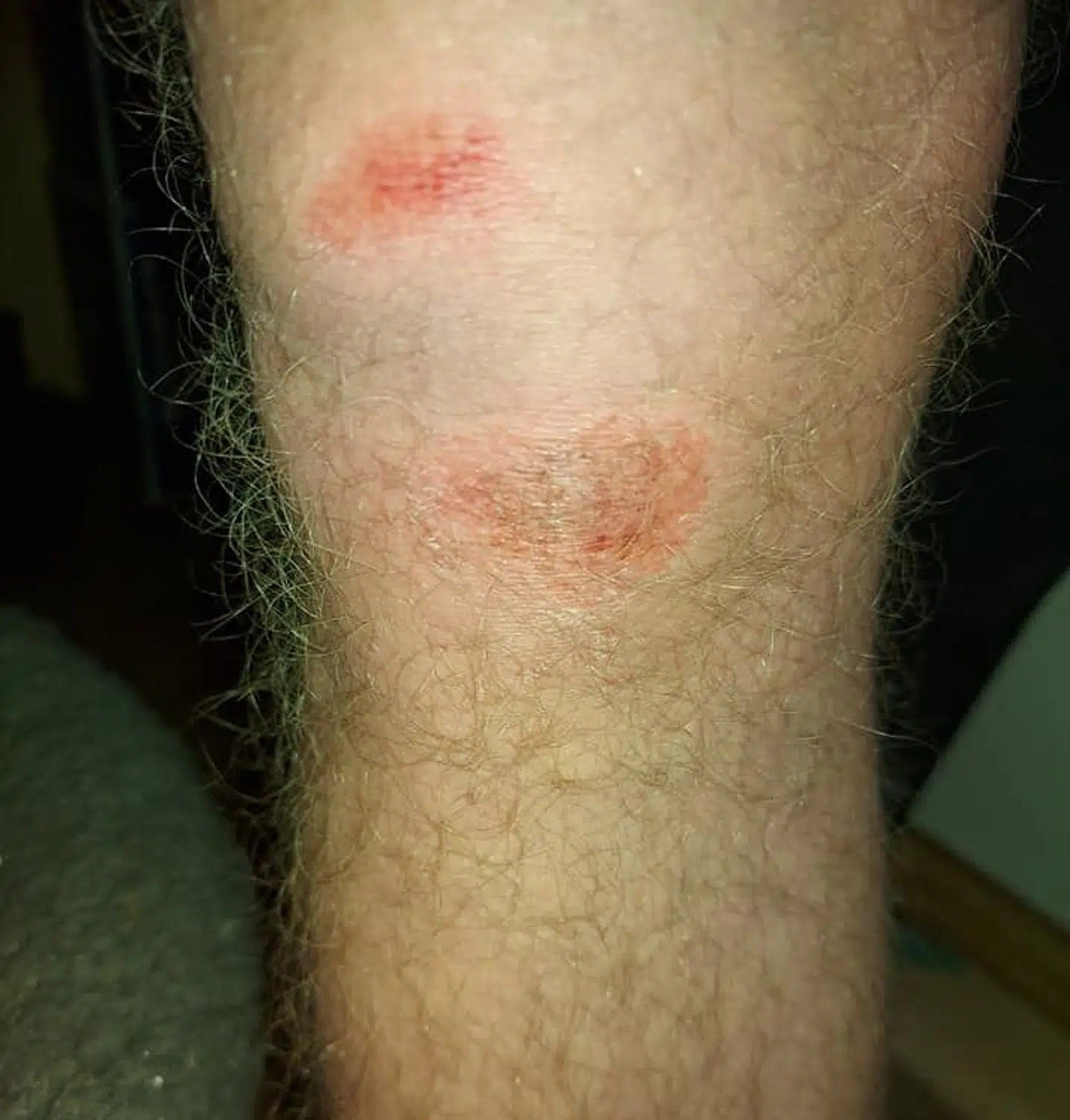 Marcus Alexander Aroli blev overfaldet af syv drenge tilbage i 2020. Nu står han frem i forbindelse med B.T. fokus på vold. Han blev slået, trampet på og forsøgt skubbet ned på skinnerne.