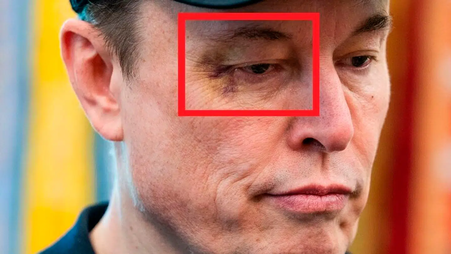 Det blå øje var tydeligt, da Elon Musk mødte op i Det Hvide Hus.