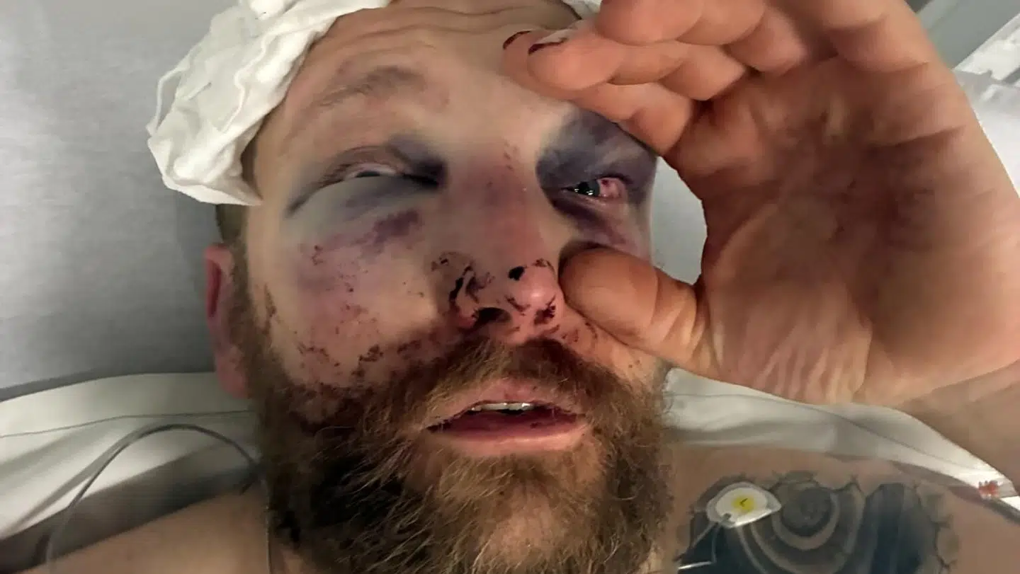 Marc Gammelmark Hertzum blev truet med kniv og herefter overfaldet af to mænd, da han forsøgte at forsvare sin søn. Politiet leder stadig efter gerningsmændene