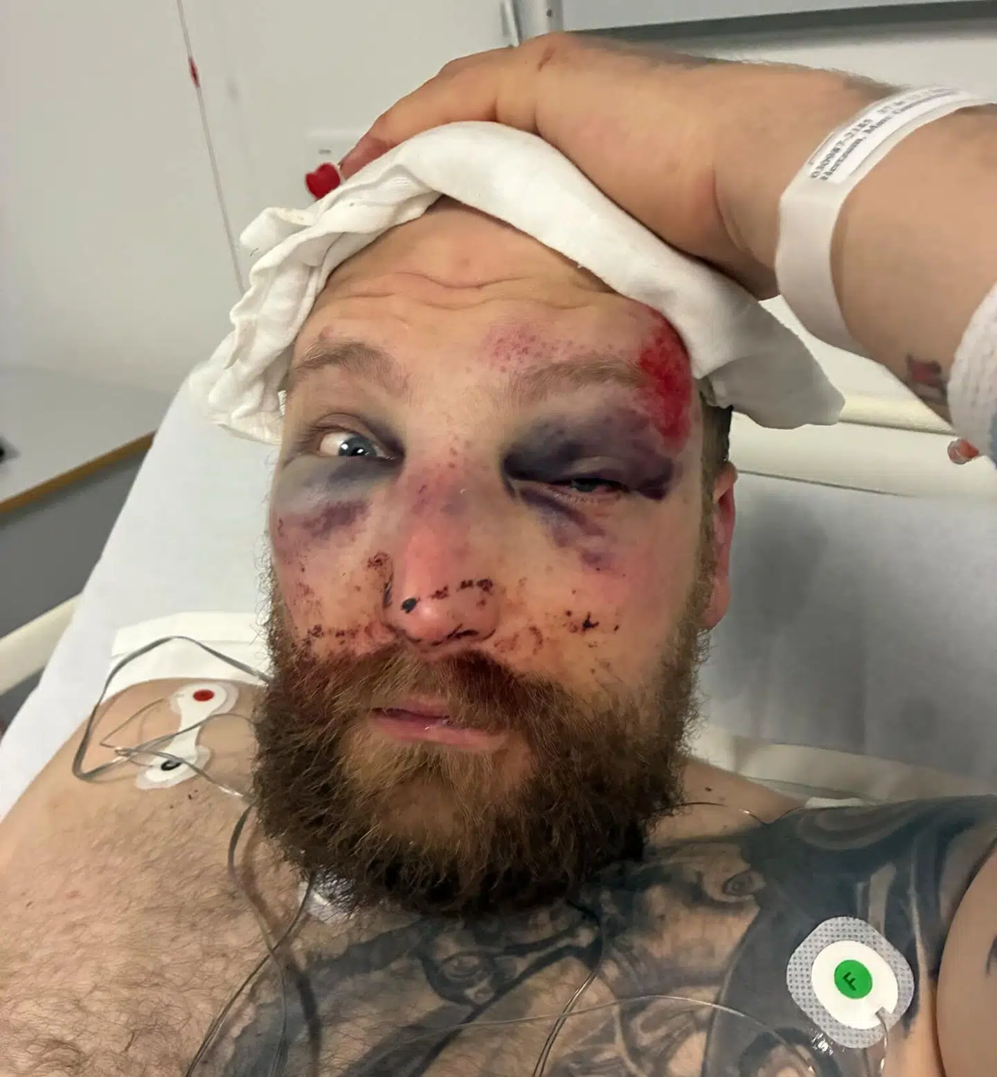 Marc Gammelmark Hertzum på hospitalet efterfølgende