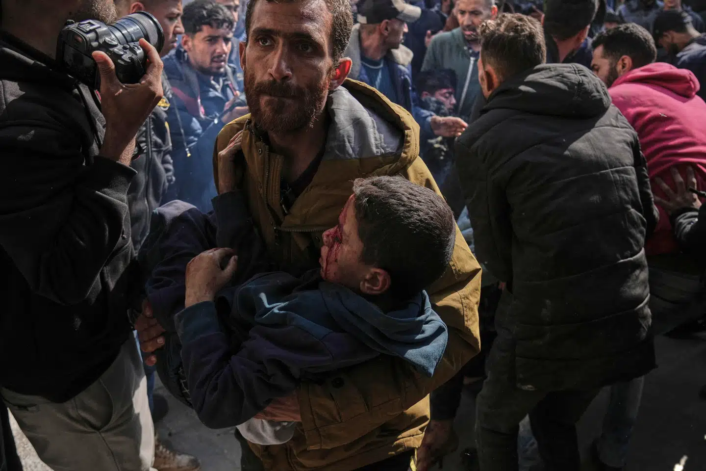 Det er hverken en realistisk eller særligt moralsk overlegen tanke at håndplukke de sårede børn i krig og flyve dem til et af Vestens forjættede lande, skriver Aminata Corr Thrane i denne leder. Her bringes et barn, der er blevet såret i et luftangreb, til Baptist Hospital i Gaza by 12. april 2025.