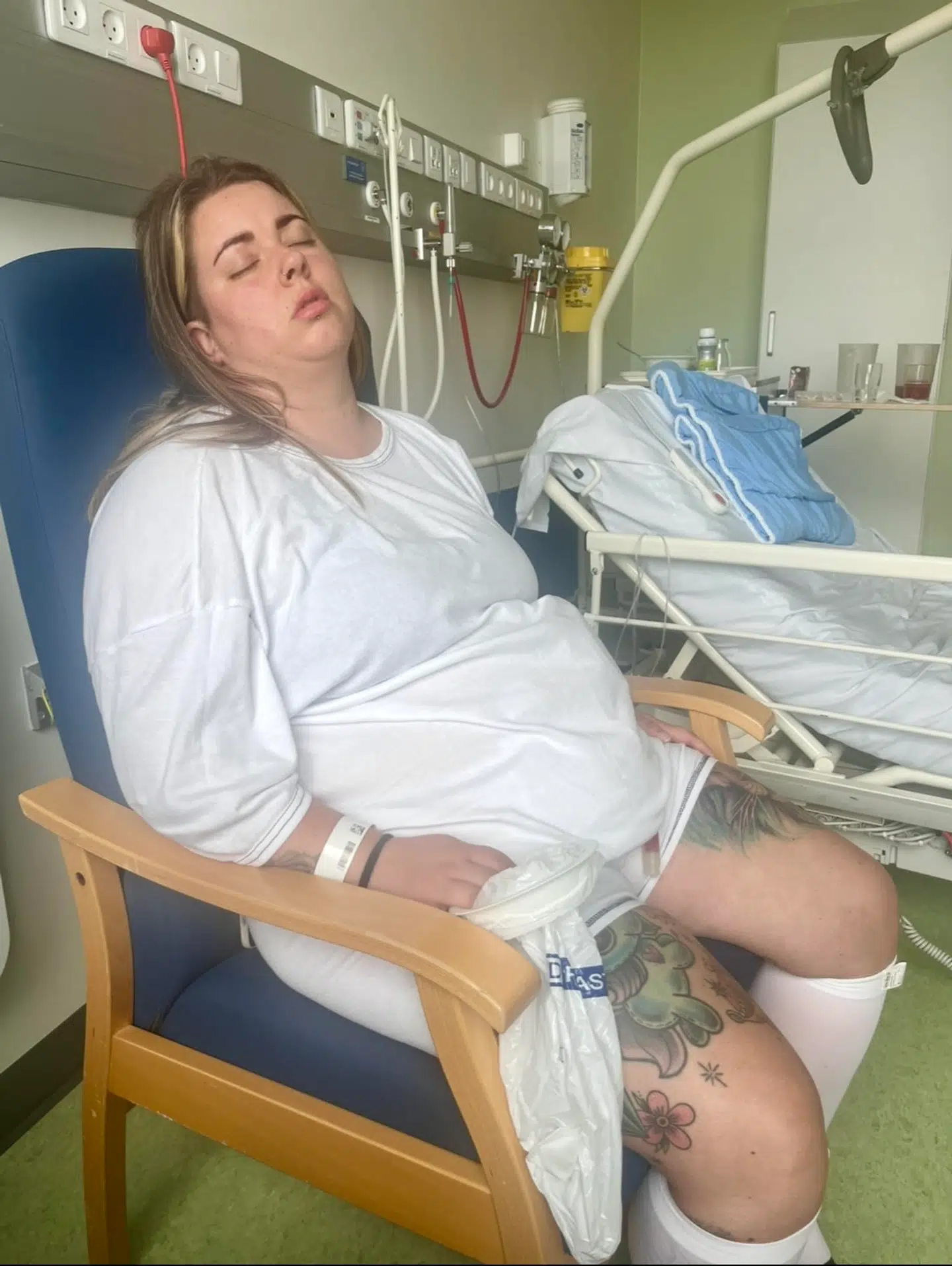 Amanda Julie Fridh Riis havde svært ved at se på sin stomi i starten.