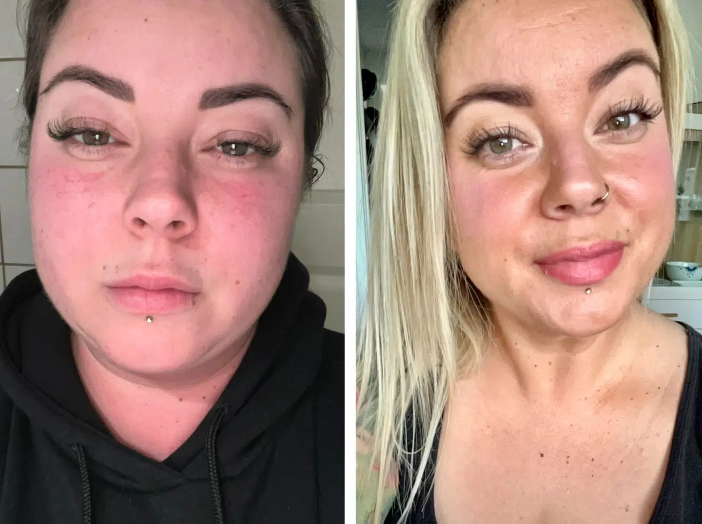 I 2022 var Amanda syg, og det påvirkede hende hårdt psykisk (t.v.) Nu i 2025 er Amanda ovenpå, glad og ikke mindst rask (t.h.).