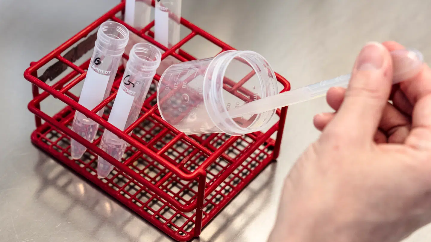 Ny forskning viser, at mikroplast kan have en negativ effekt på sædkvaliteten.