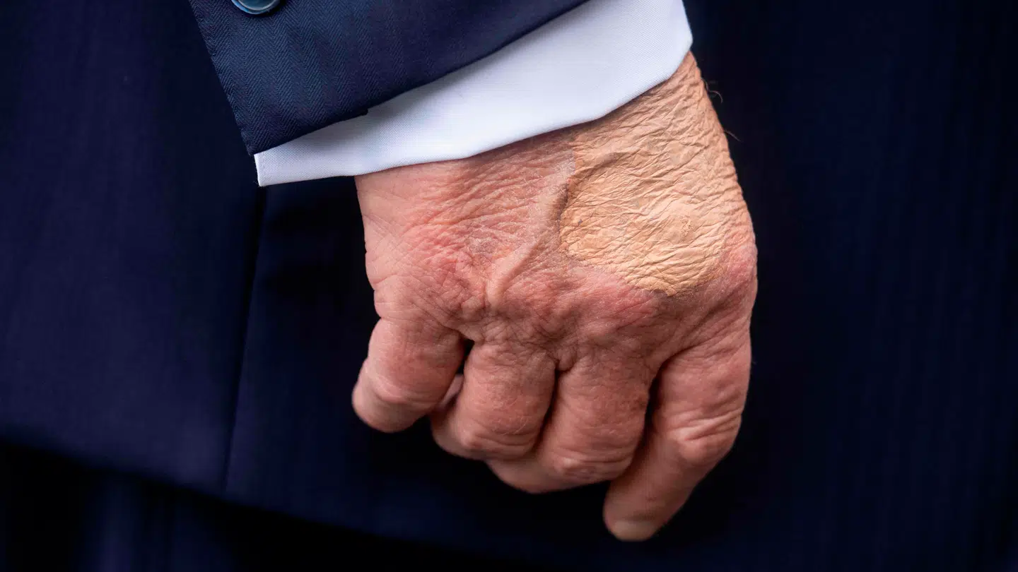 Den amerikanske præsident Donald Trumps højre hånd ses her, mens han taler til pressen, inden han går om bord på Marine One på den sydlige græsplæne ved Det Hvide Hus.