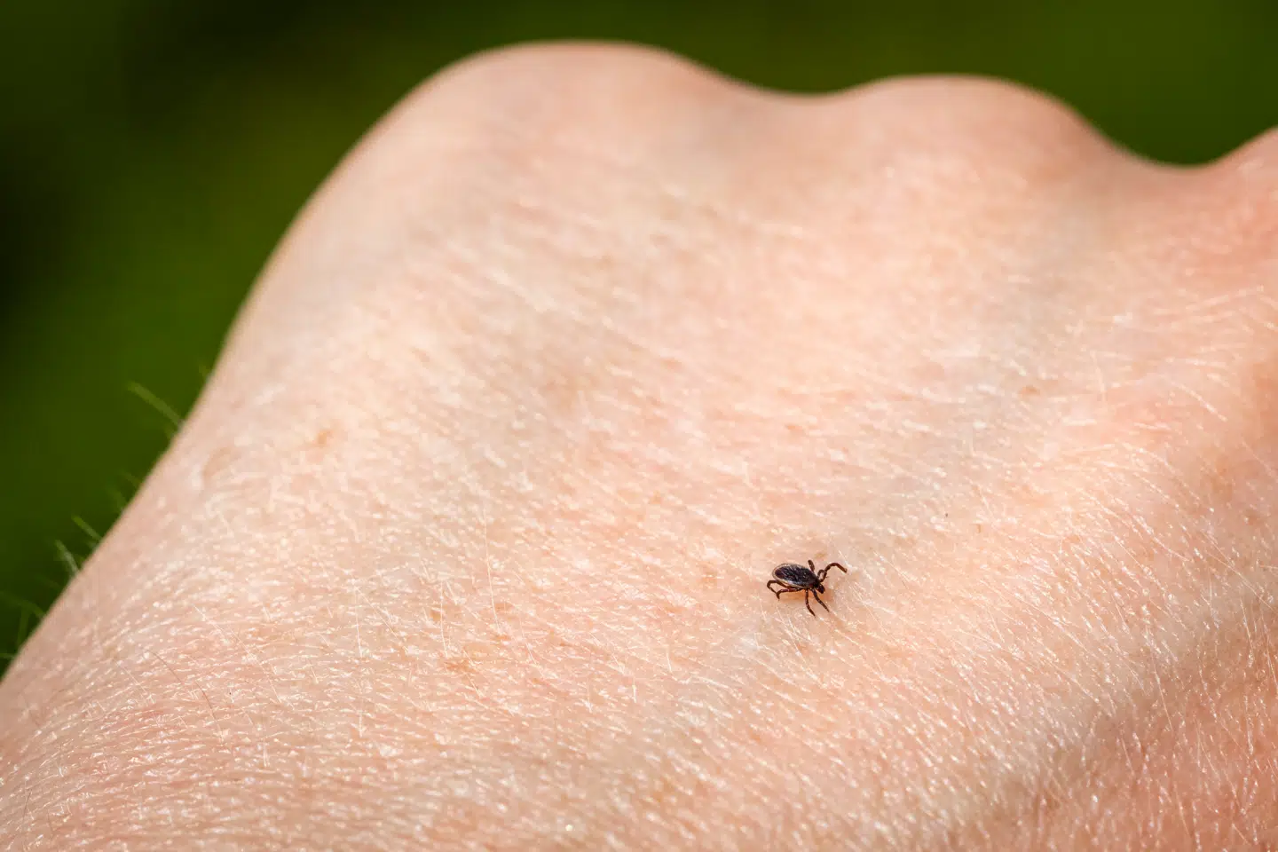 Flåt på hånd fotograferet i Tisvilde i Nordsjælland mandag den 27. maj 2024. Flåter eller skovflåter, små mider med 8 ben som suger blod fra fugle og pattedyr - herunder mennesker.. (Foto: Ida Marie Odgaard/Ritzau Scanpix)