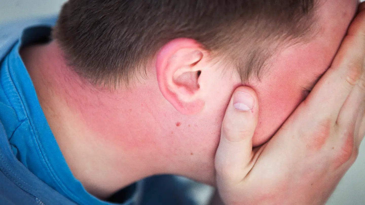 Solens stråler er farlige, særligt, hvis du glemmer solcremen.