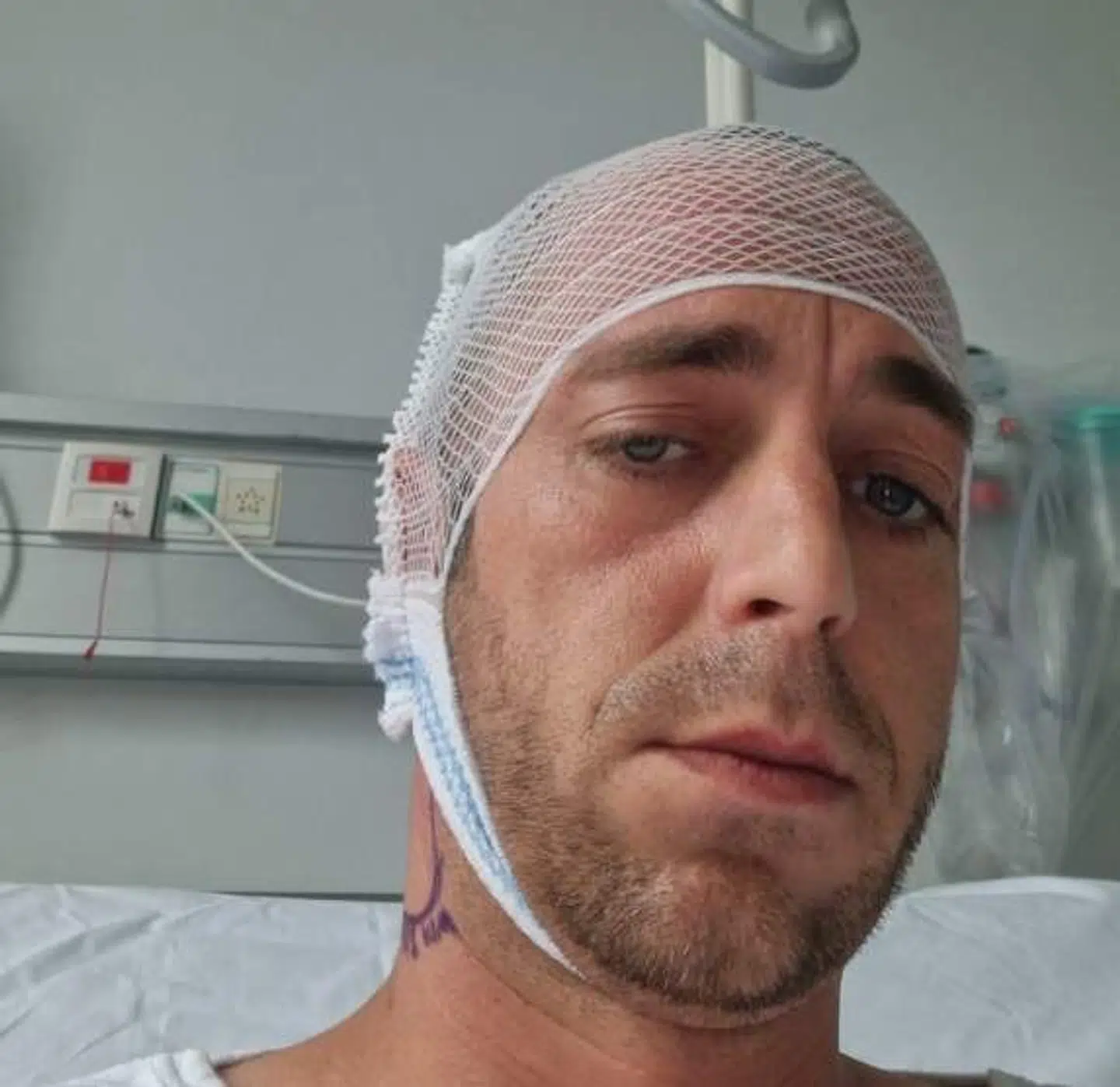 Her ses Morten Skjødt Knudsen efter overfaldet