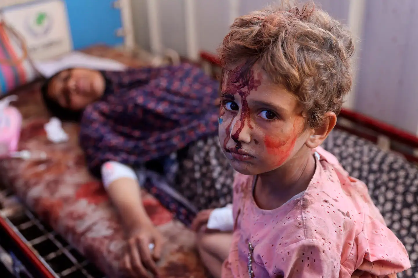 Sagen om Gazas børn viser tydeligt, hvor destruktive asylreglerne er blevet, skriver Klaus Wivel. Her ses et såret børn i Al-Ahli Arab-hospitalet i Gaza By efter et israelsk bombeangreb ramte to skoler 4. august. Foto: Omar Al-Qattaa, Scanpix