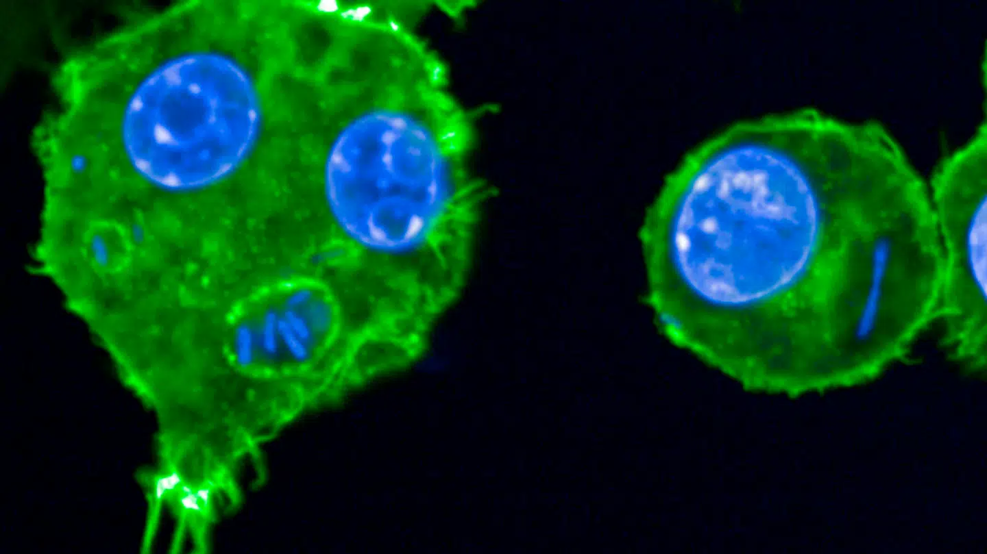 Pest forårsages af bakterien Yersinia pestis og smitter mennesker gennem bid fra inficerede lopper eller kontakt med inficerede dyr.