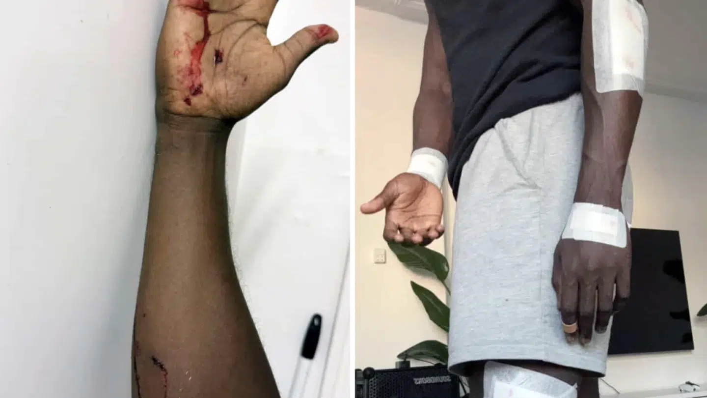 Gabriel Gonzalez er blevet skambidt af nådesløs hund.