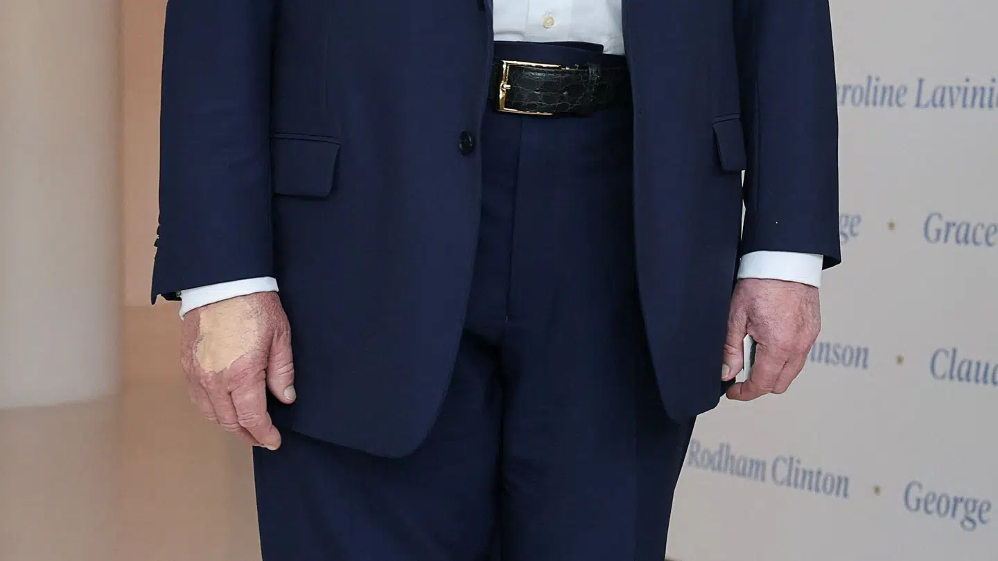 Her ses pletten af makeup tydeligt på Donald Trumps højre hånd.