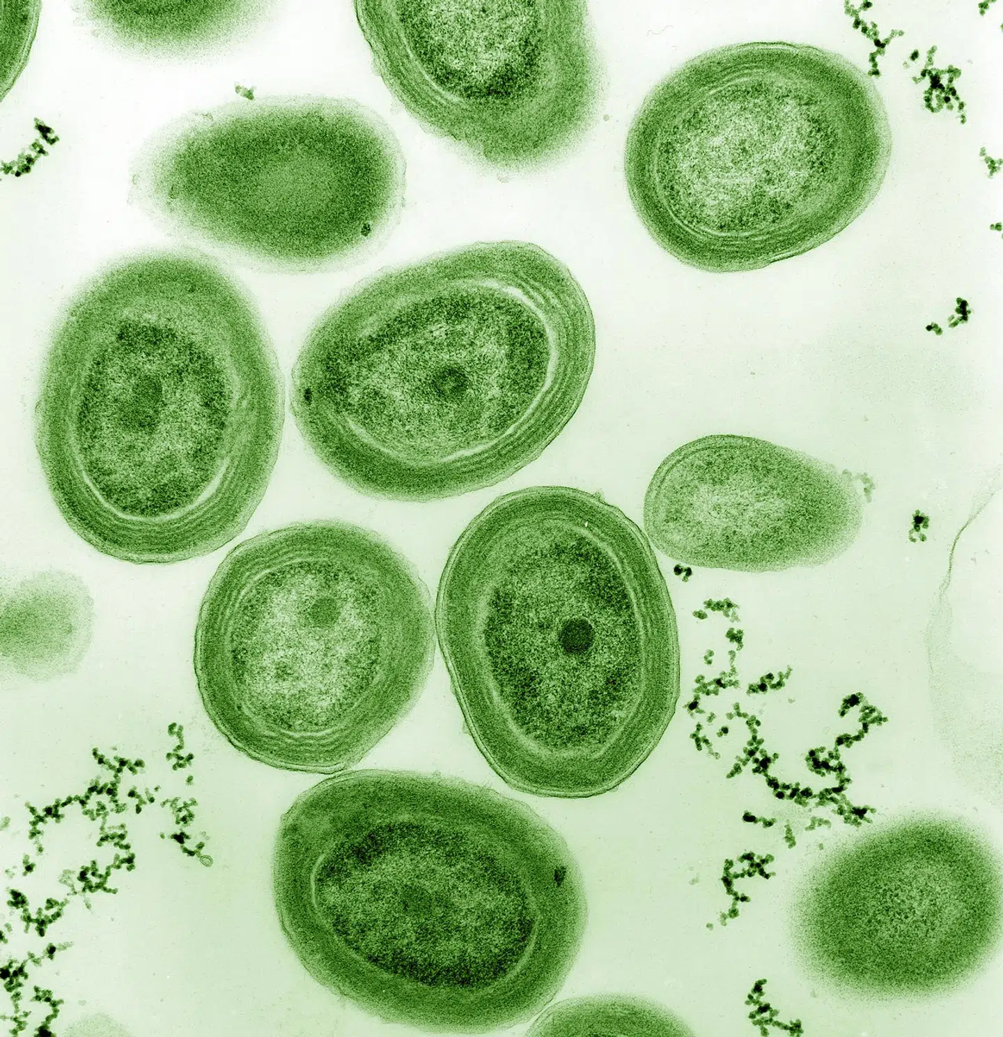 Prochlorococcus marinus set gennem et mikroskop. Foto: Luke Thompson, Scanpix
