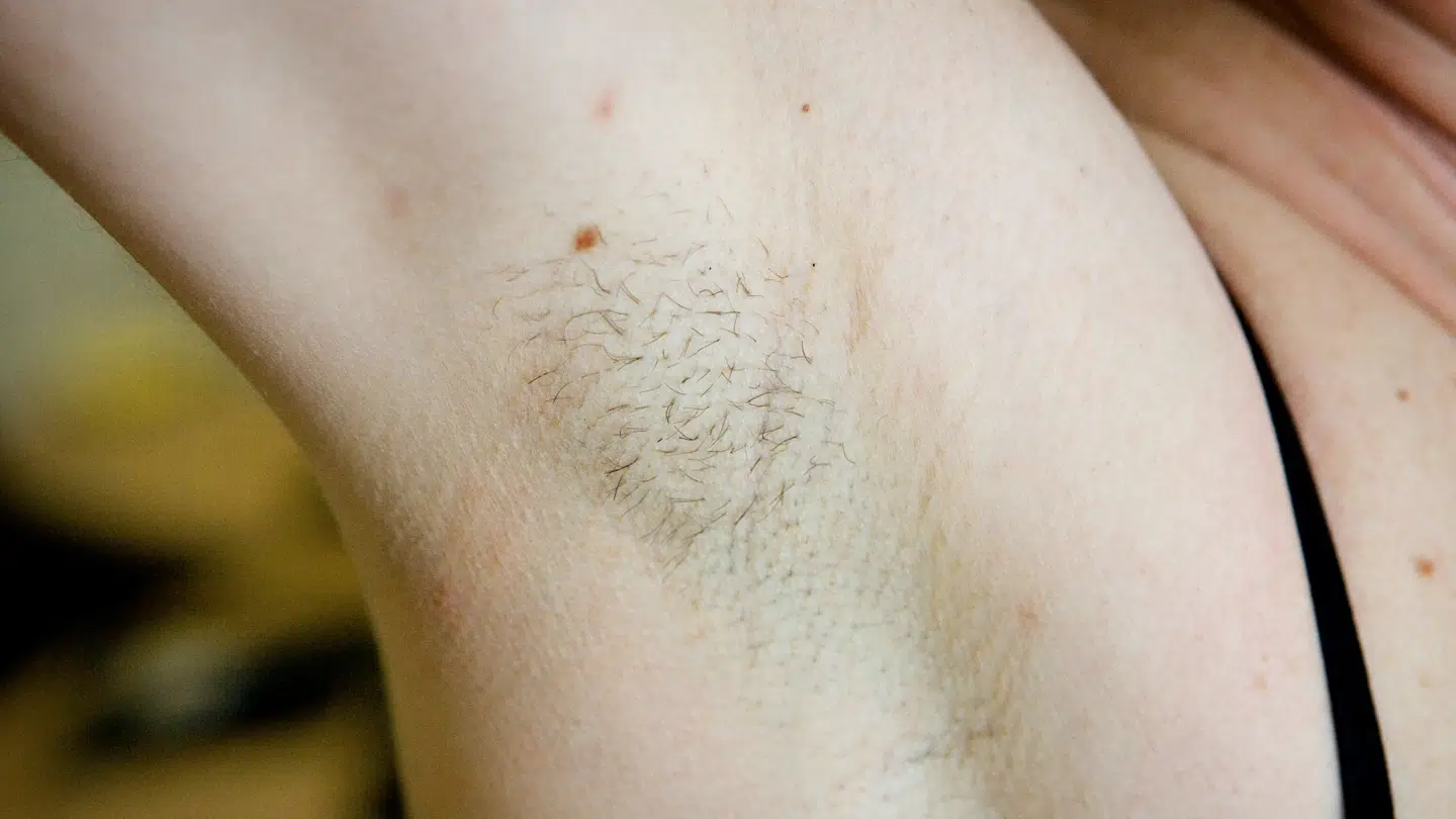 (Arkiv) Armhulerne gør nas, efter brug af roll-on deodorant af brandet Mitchum.