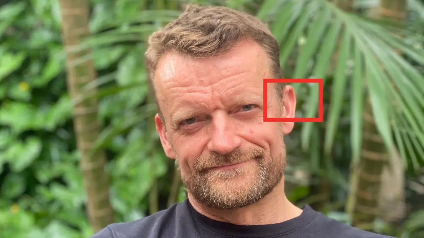 Frank Hvam er begyndt at gå med høreapparat. Foto: Privat