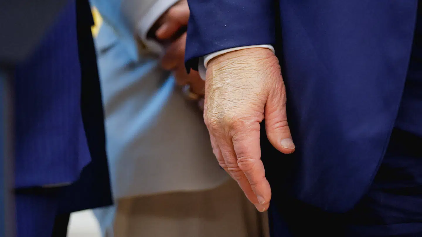 Trumps højre hånd med makeup på.