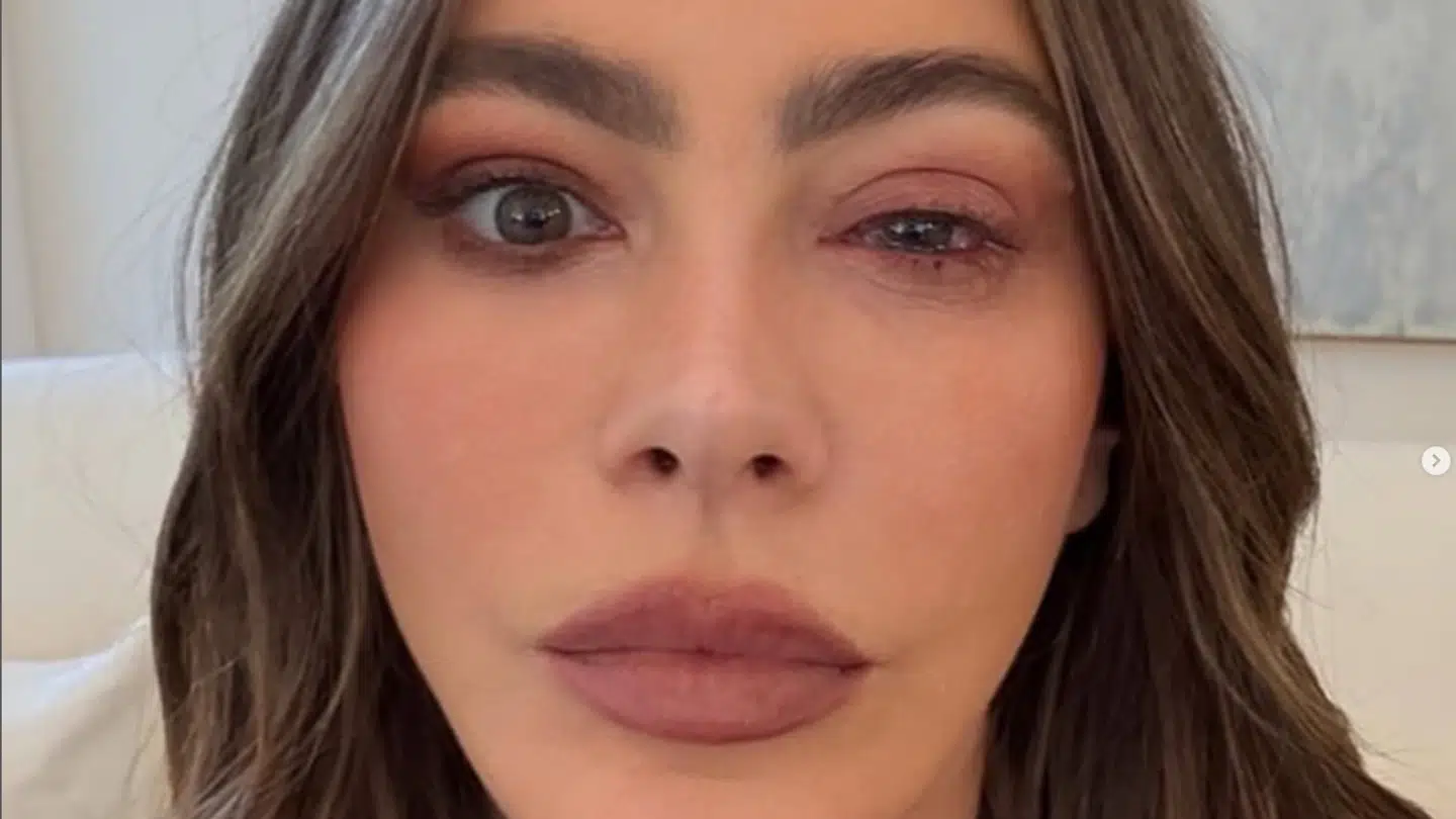 Her ses et billede, som skuespilleren Sofía Vergara selv har delt af sit øje.