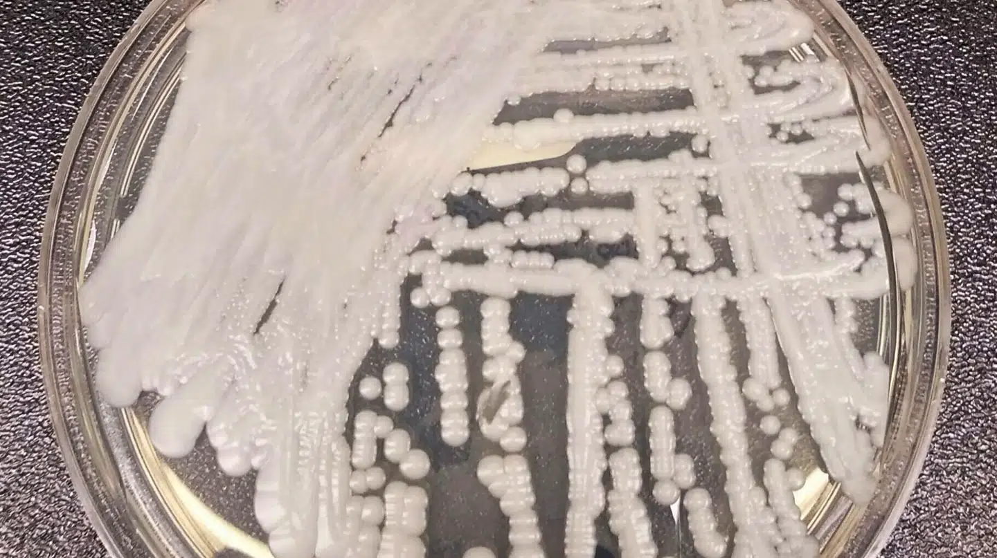 C. auris er en gærsvamp, der kan være dødelig for svækkede patienter. Den er resistent over for mange typer antibiotika og udgør derfor en risiko på hospitaler og plejehjem. På billedet ses en stamme af svampen dyrket i et laboratorium.