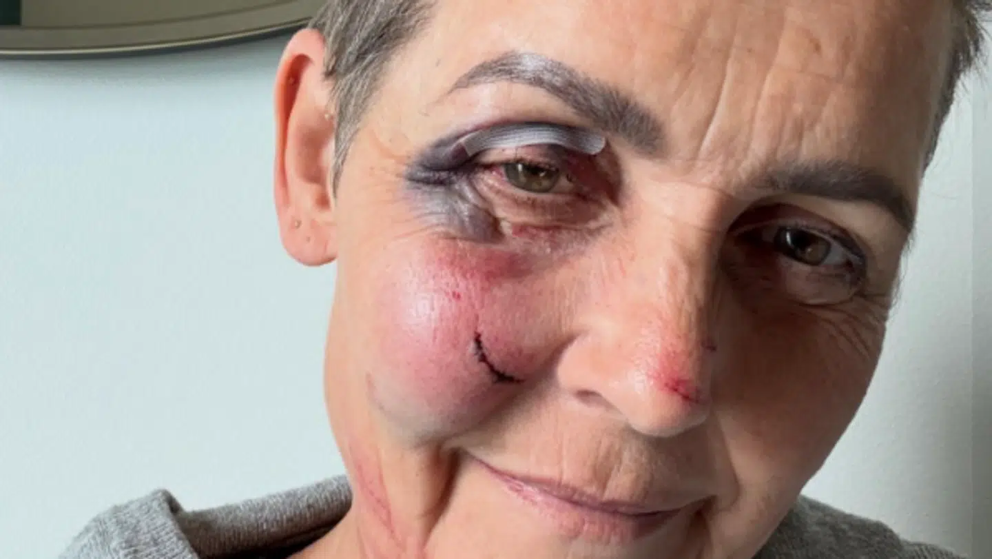 Pia Olsen Dyhr delte dette billede i forbindelse med sit styrt.