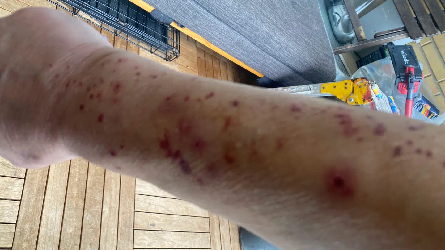 Maje Dixøs arme efter kort ophold i lejligheden.