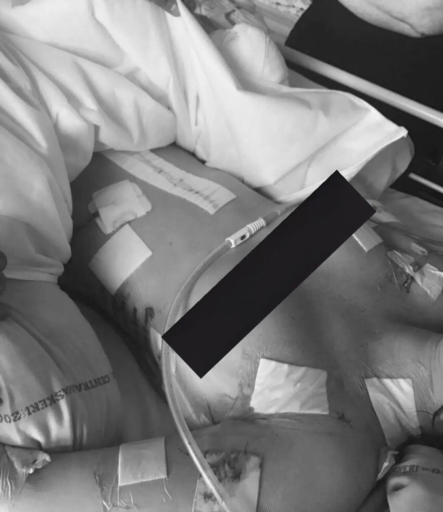 Cecilie efter drabsforsøget.