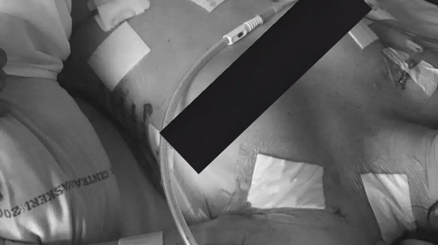 Cecilie Danris efter det voldsomme drabsforsøg