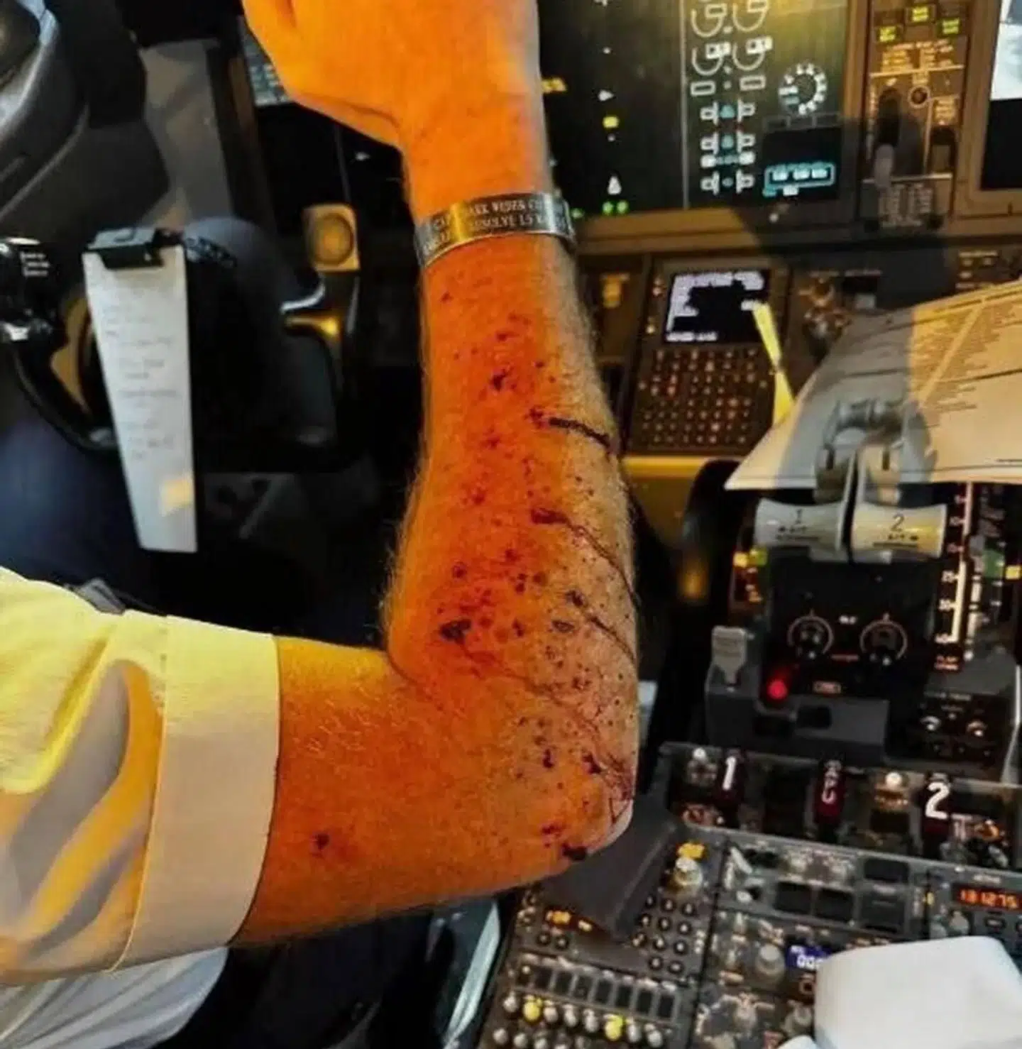 Piloten kom til skade under den usædvanlige hændelse.