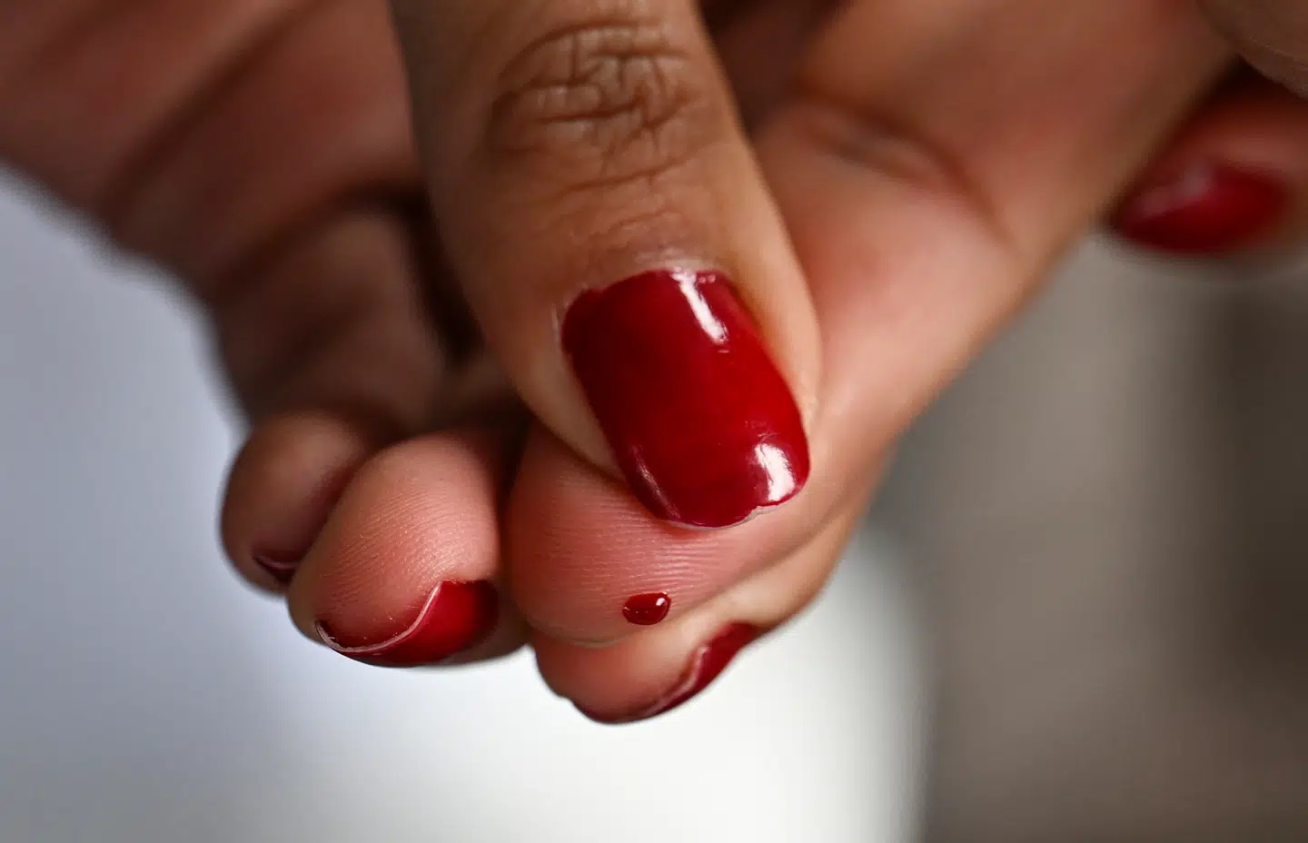 Forskere håber, at ny teknologi kan være med til hurtigere at diagnosticere sygdomme, der skyldes dårlig blodcirkulation. Arkivfoto: Yuri Cortez