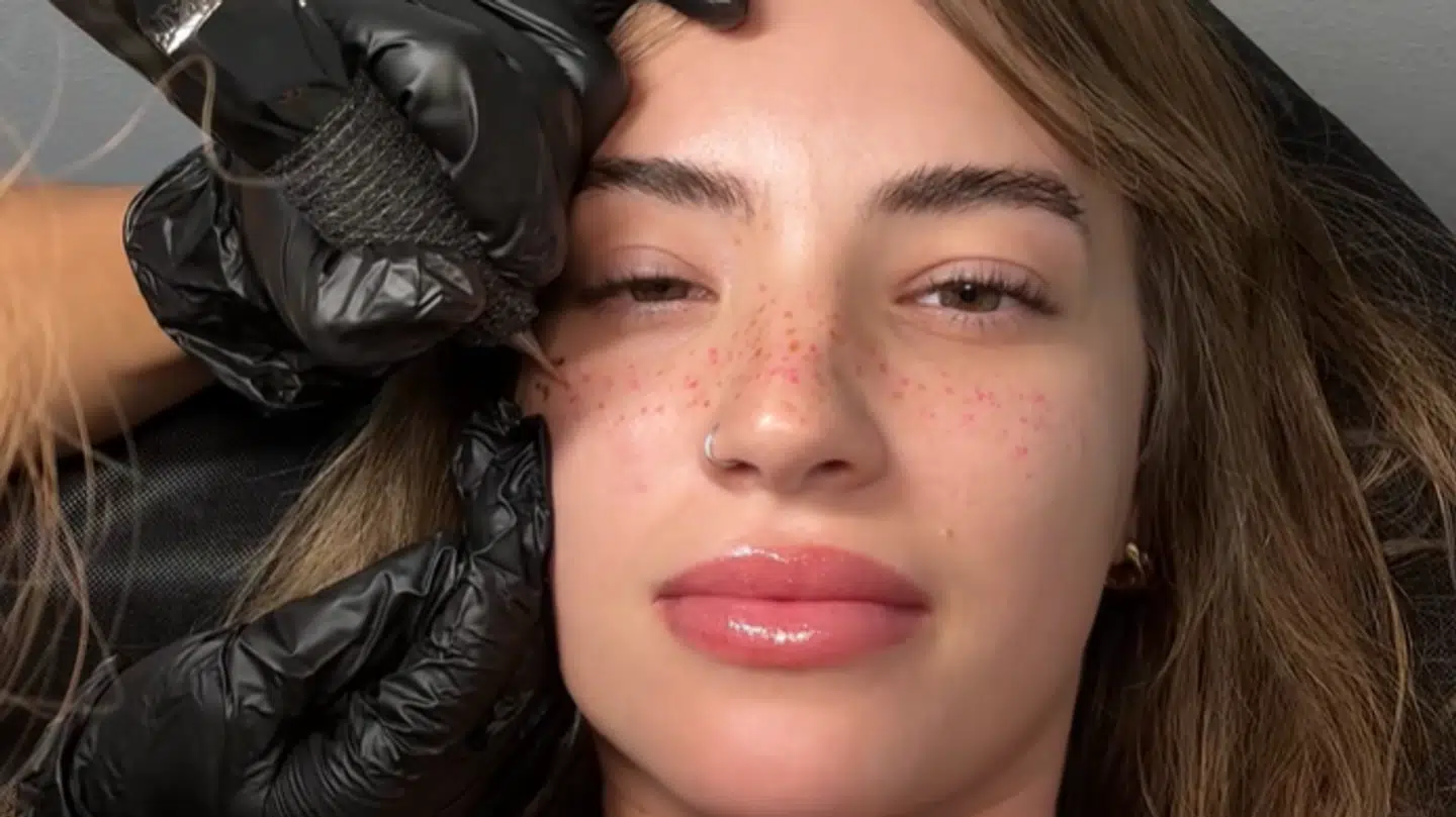 Sierra Cannon var træt af at tegne fregnerne op, så hun besluttede at få dem tatoveret.