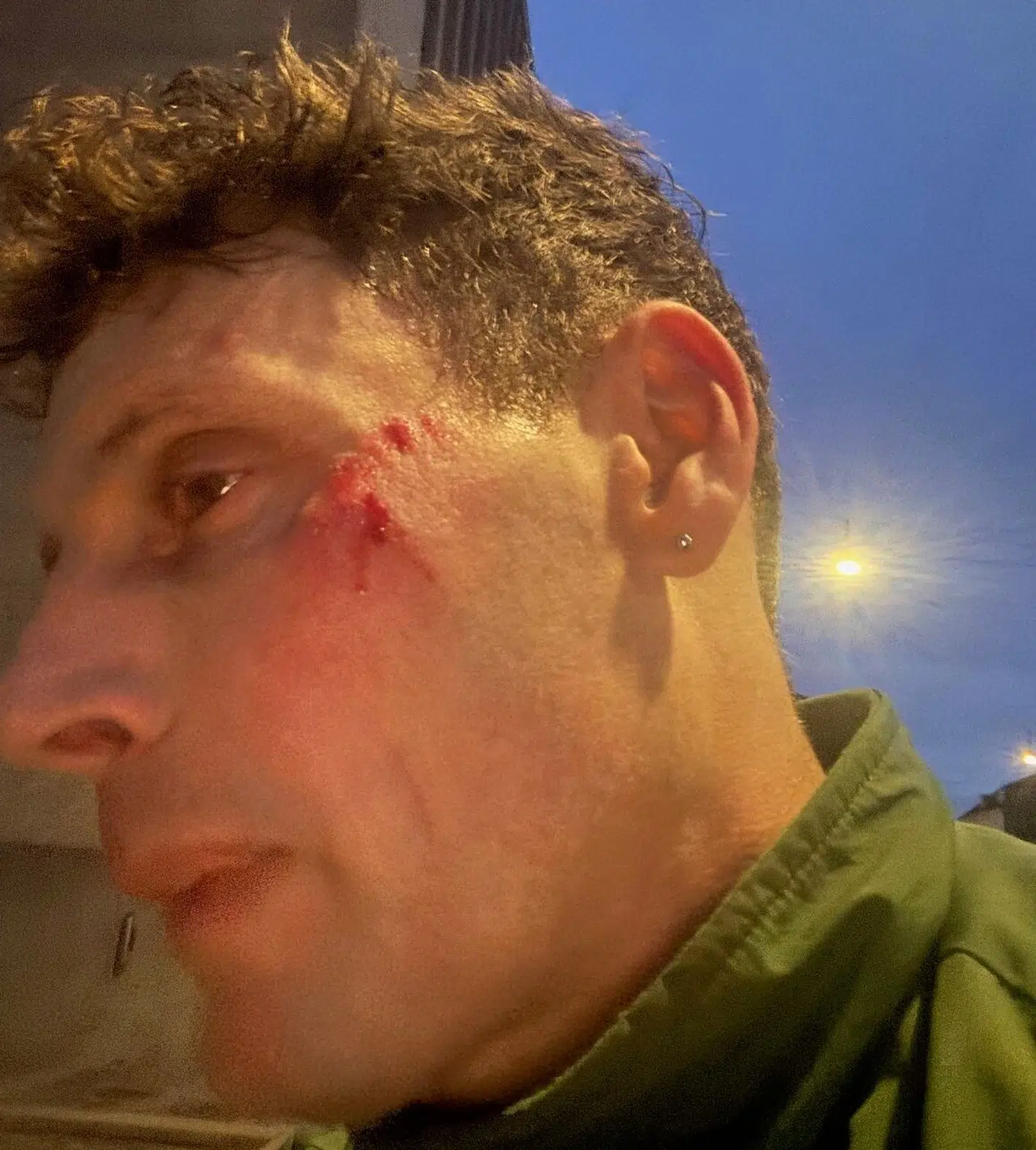 Den konservative lokalpolitiker fik skrammer i ansigtet efter cykelstyrtet.