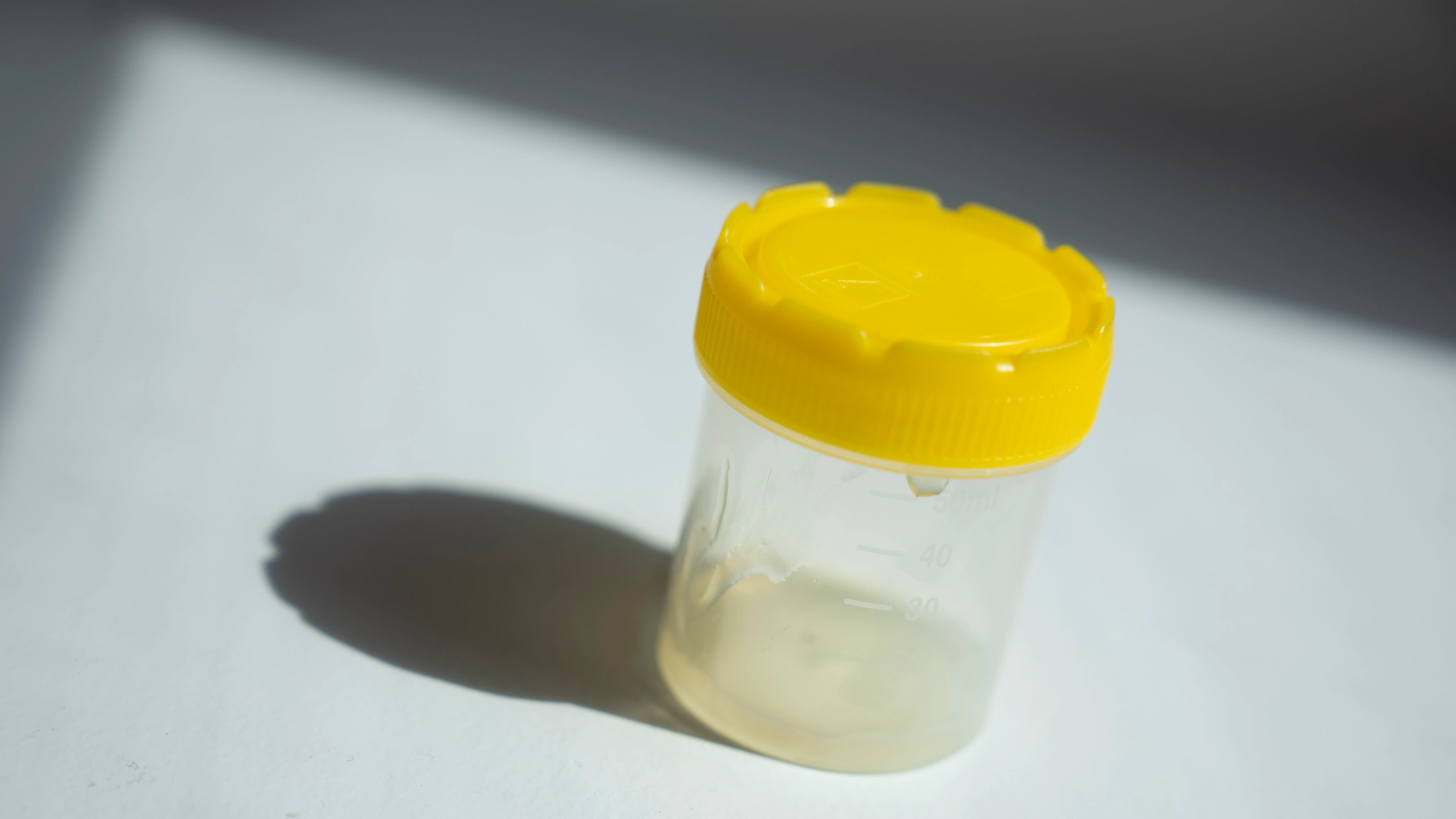 Dansk sædbank kritiseres for IQ-test: 'Helt ukontroversielt at undersøge'