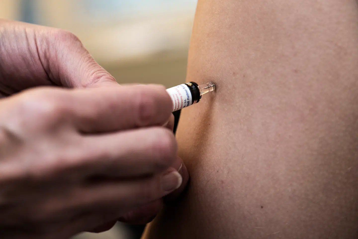 Medicinalvirksomheder arbejder på vacciner imod EBV, som hvis gives tidligt i livet, kan den potentielt forhindre udviklingen af lupus og andre autoimmune sygdomme forårsaget af EBV. Arkivfoto: Kristian Djurhuus, Scanpix.