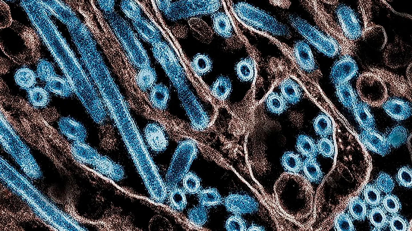 Arkivfoto. Her ses et billede af en H5N1-virus, der adskiller sig en smule fra den, der netop er blevet fundet i en amerikansk mand.