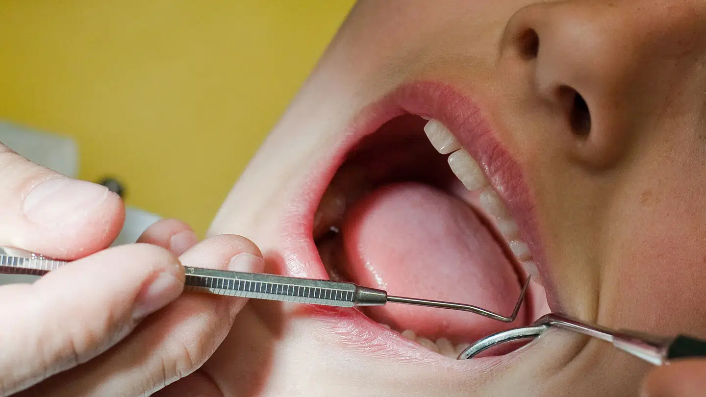 Mange danskere, der lider af mavetarmsygdommene Crohns sygdom og Colitis Ulcerosa, har store problemer med deres tænder. Det koster dem dyrt i tandlægeregninger.