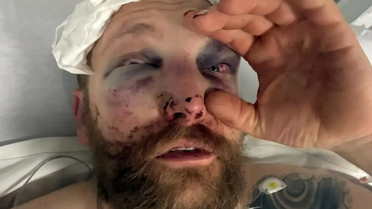 Marc Gammelmark Hertzum blev truet med kniv og herefter overfaldet af to mænd, da han forsøgte at forsvare sin søn.