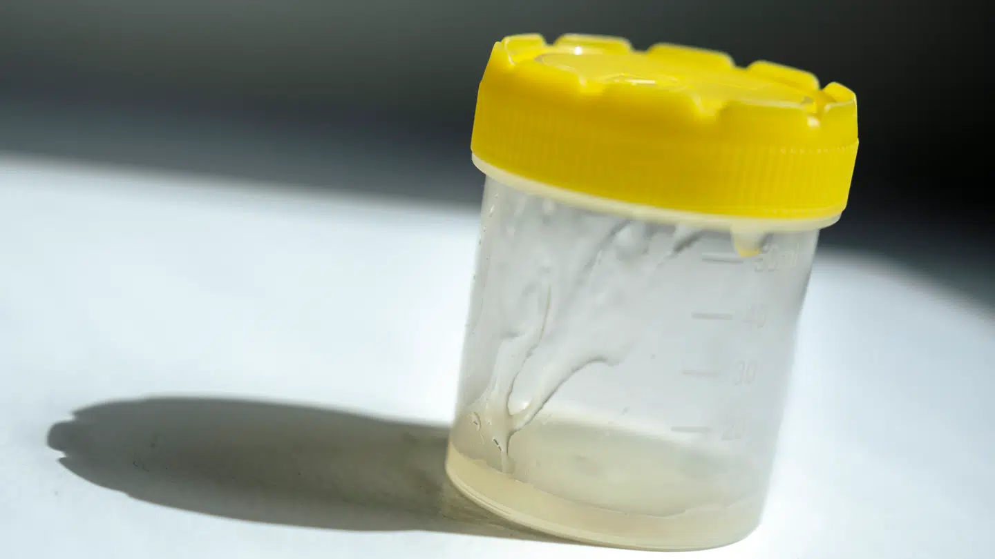 (Arkiv) Sæd fra en dansk donor med mutation, der øger risikoen for kræft, er ved fejl sendt til rigtig mange klinikker rundt om i verden.