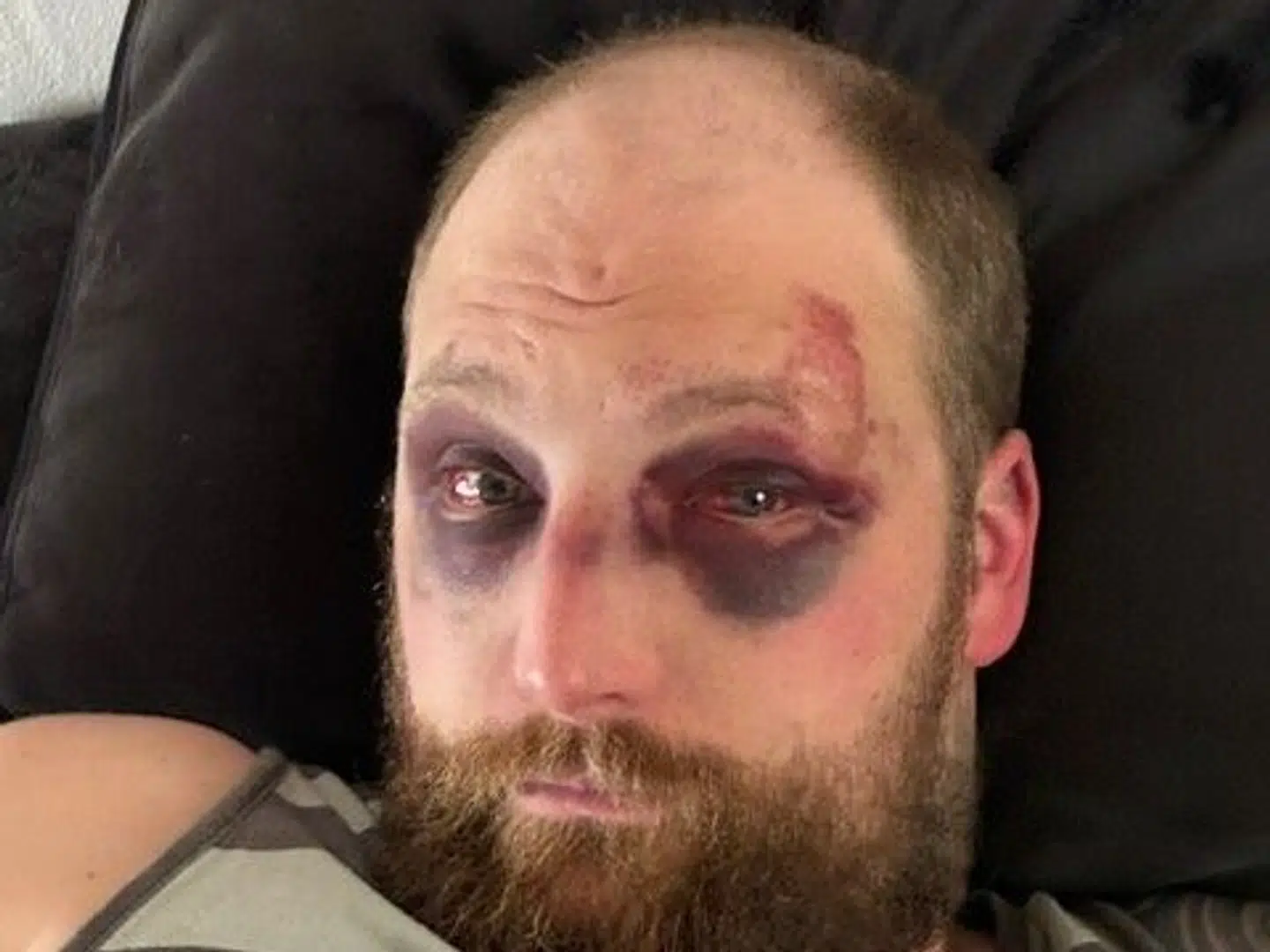 Her ses Marc et par dage efter overfaldet.